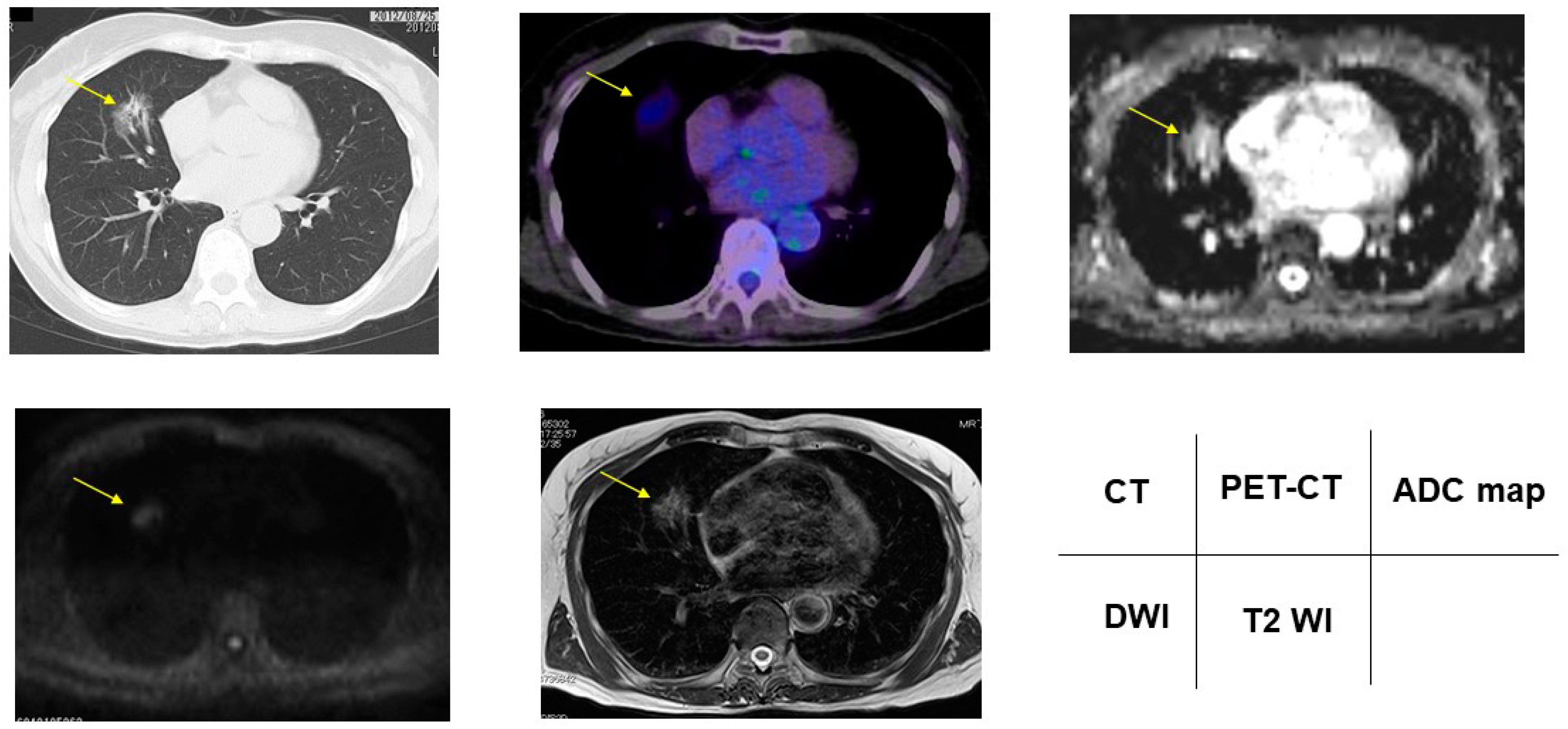 Cancers 13 05166 g003