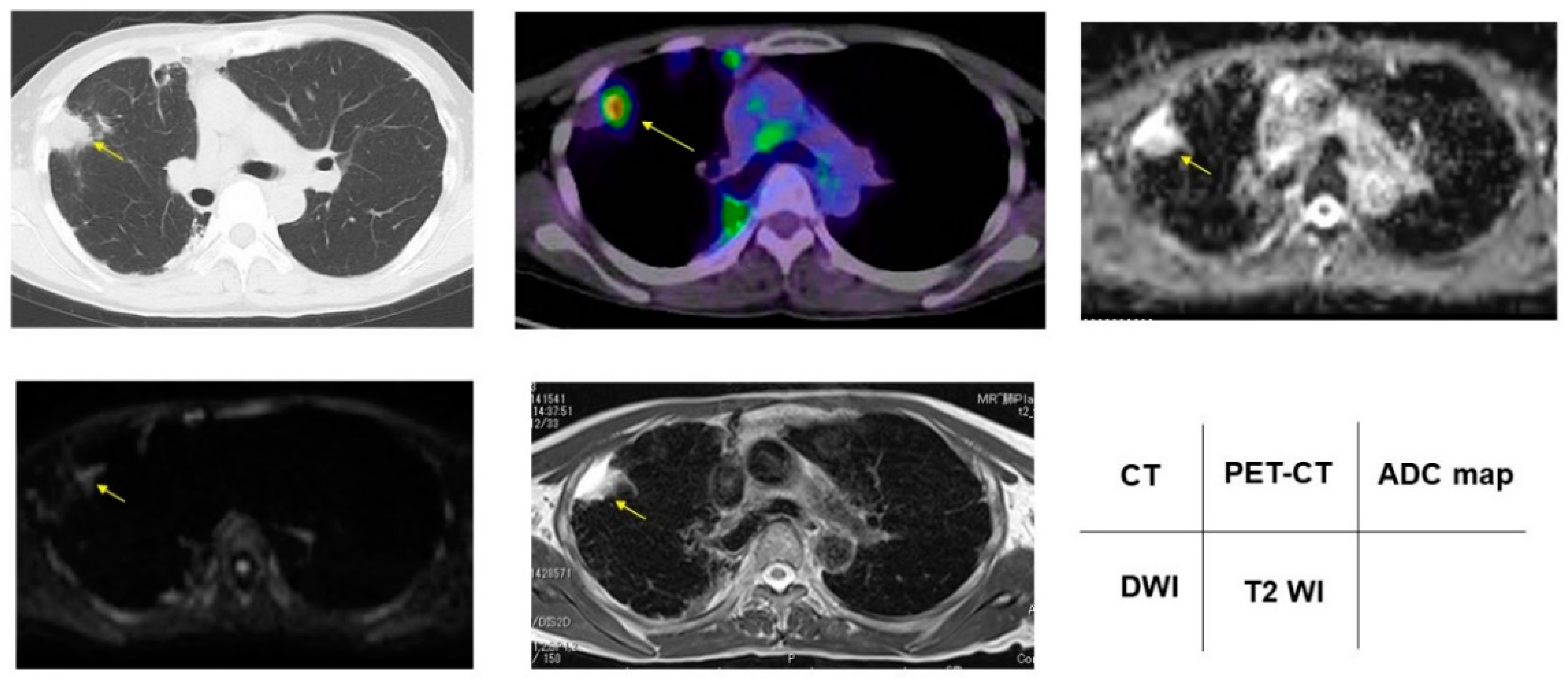 Cancers 13 05166 g004