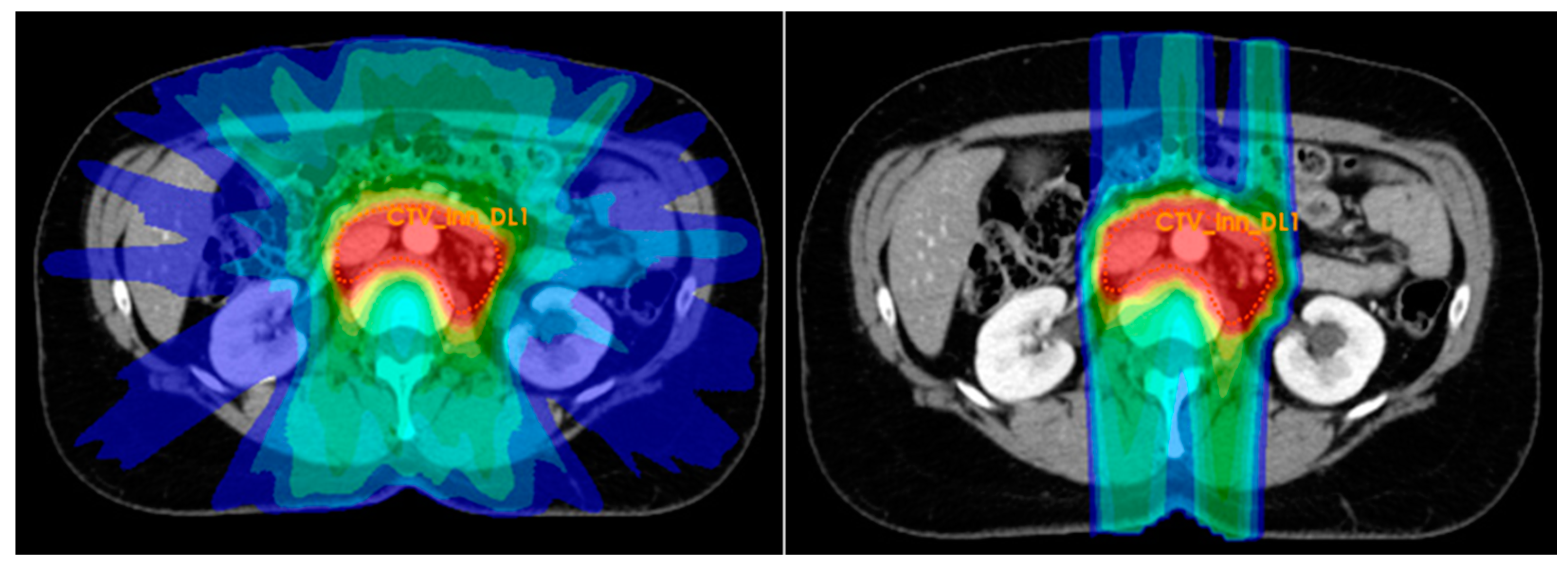 Cancers 13 05179 g001