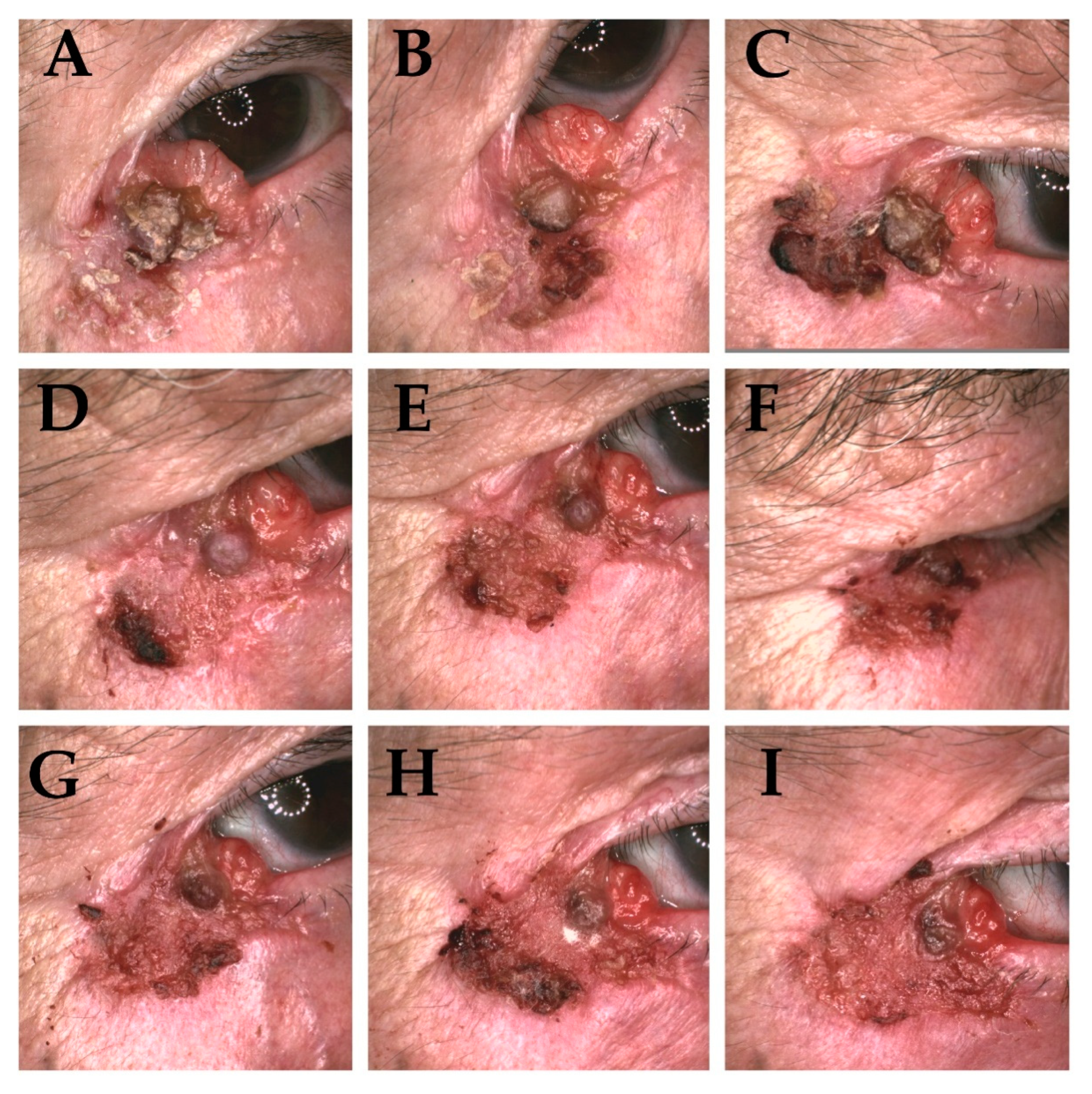 Cancers 13 05188 g003 550