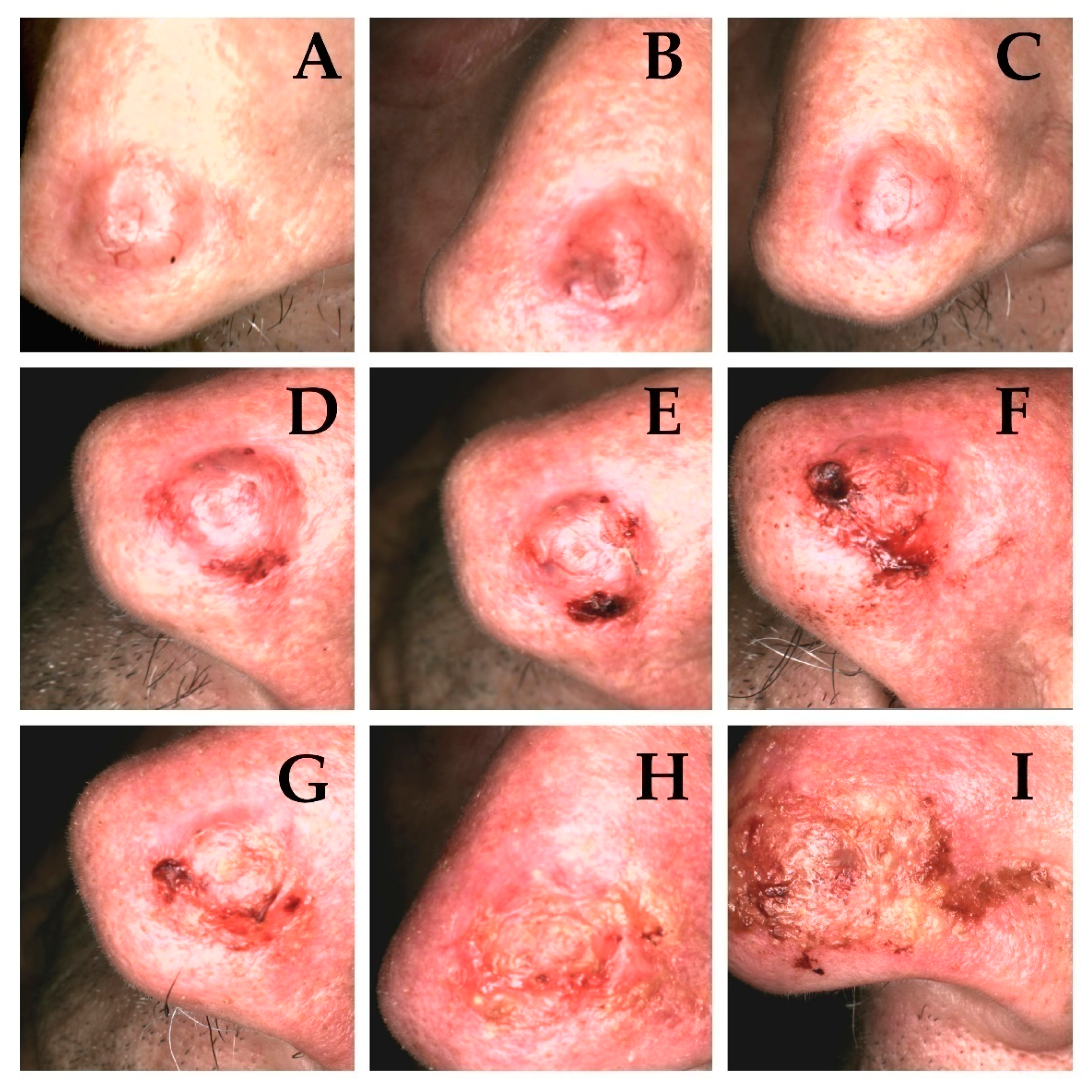 Cancers 13 05188 g004 550