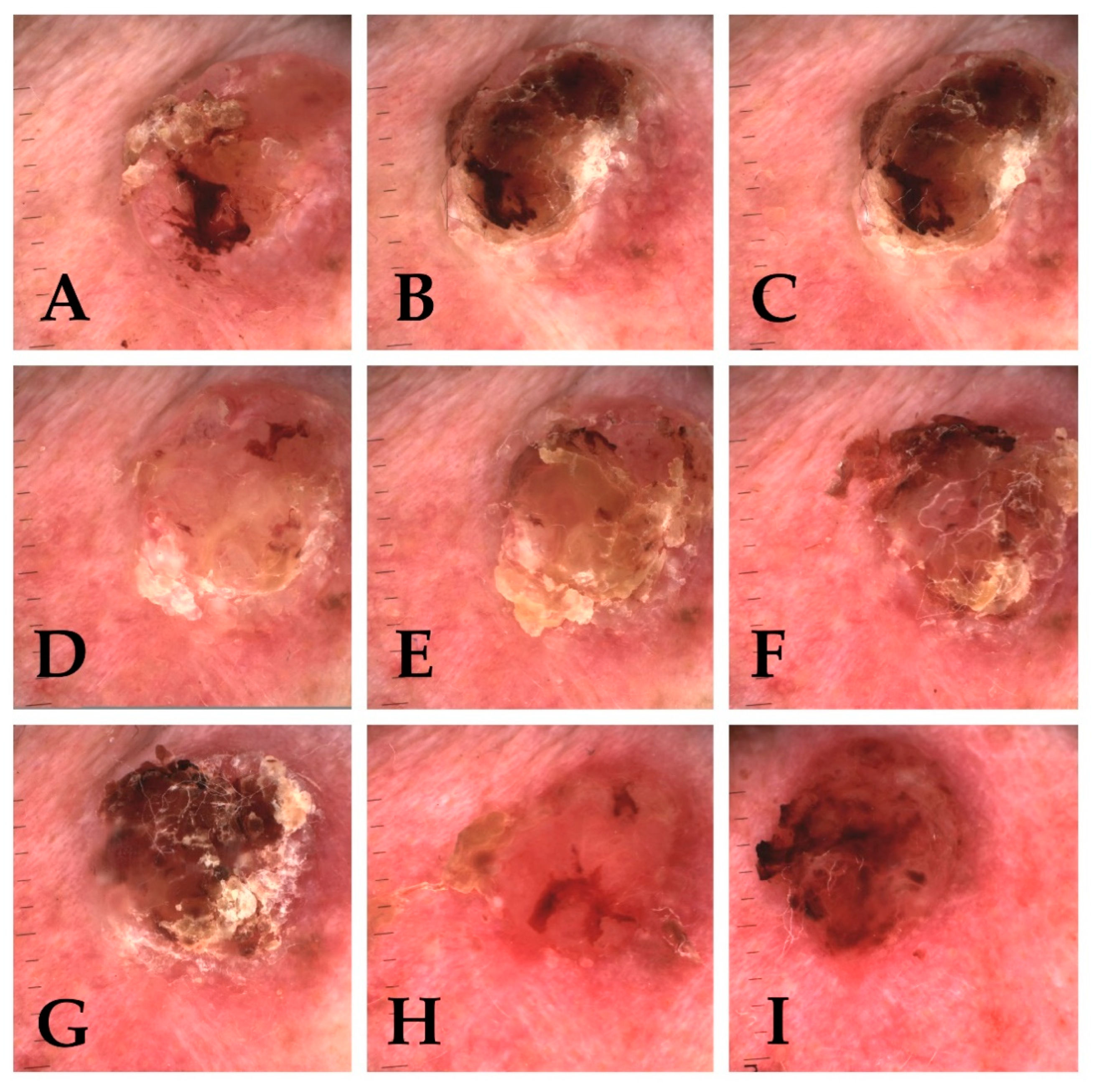 Cancers 13 05188 g006 550