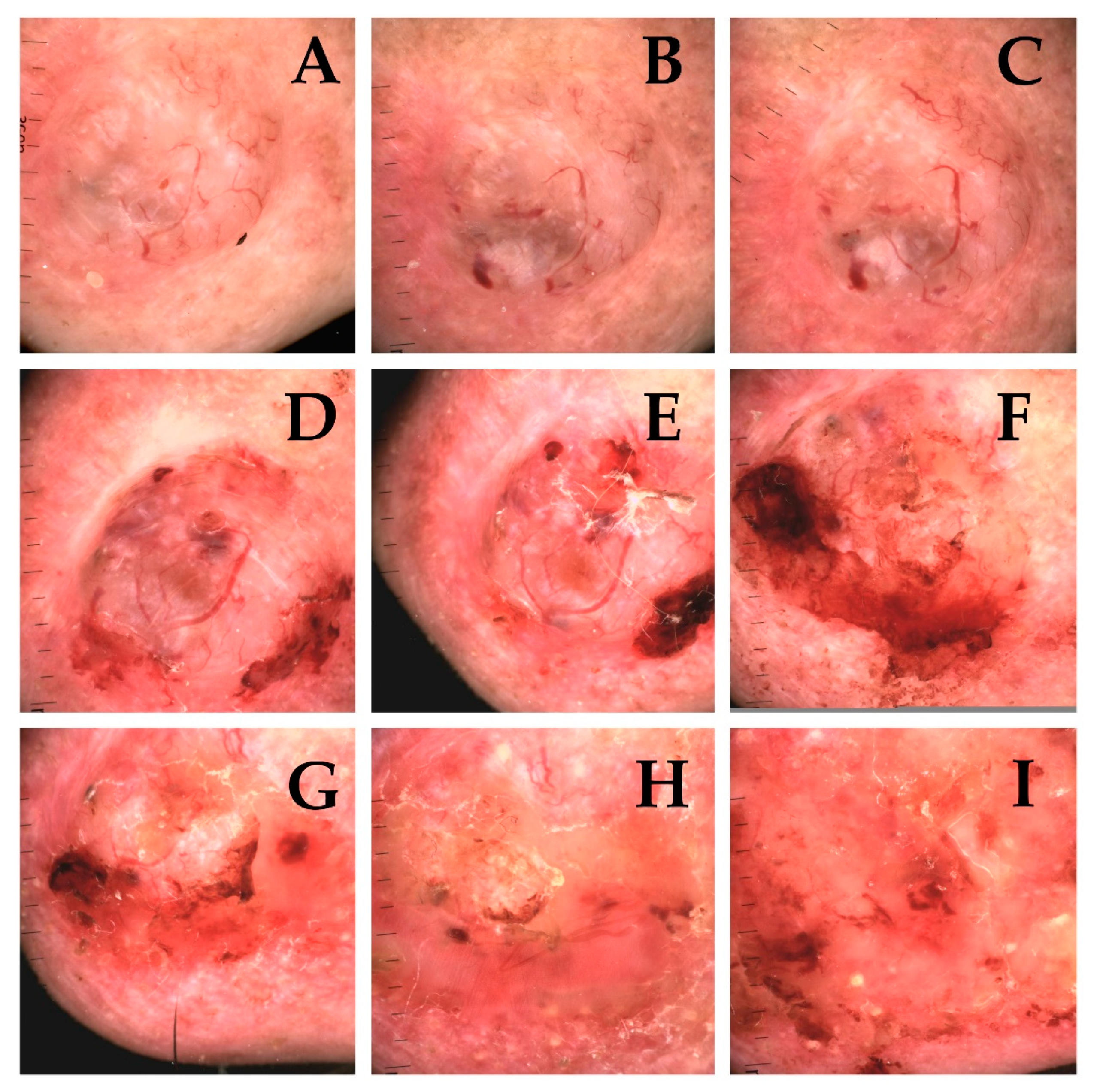 Cancers 13 05188 g007 550