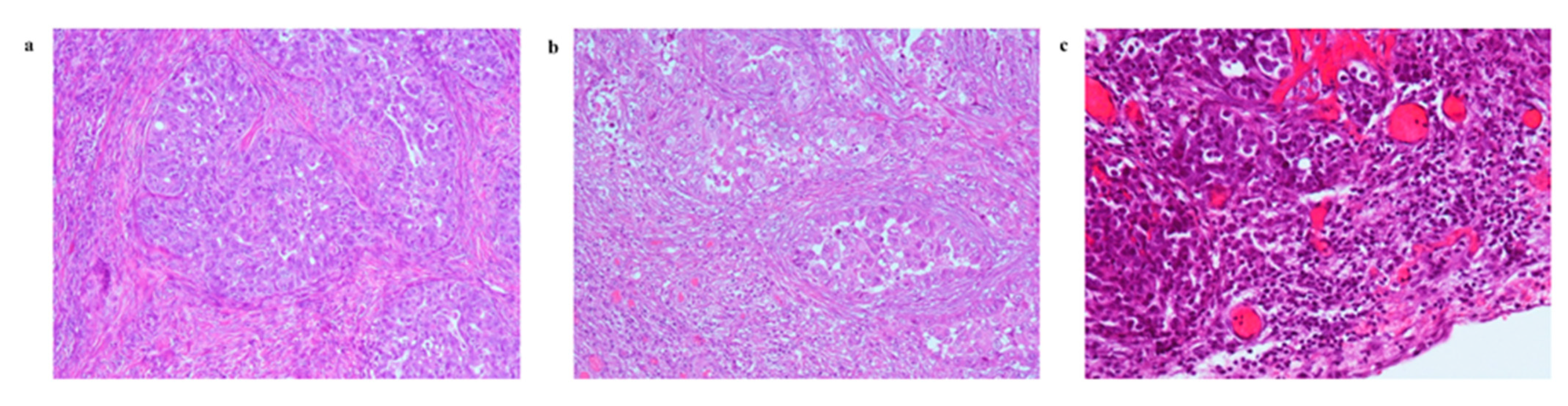 Cancers 13 05200 g002 550