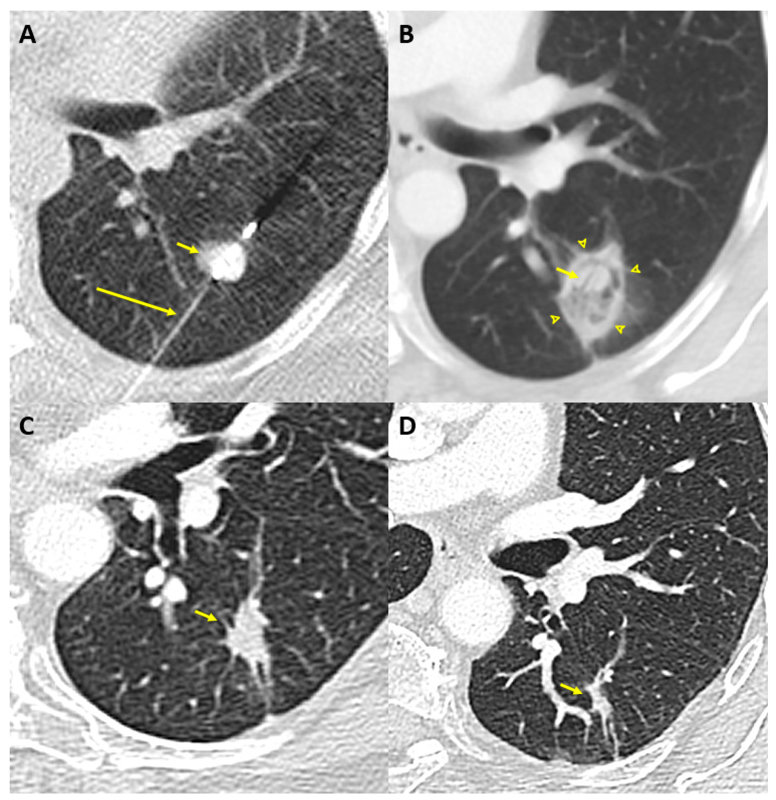 Cancers 13 05202 g001 Cancers 13 05202 g001