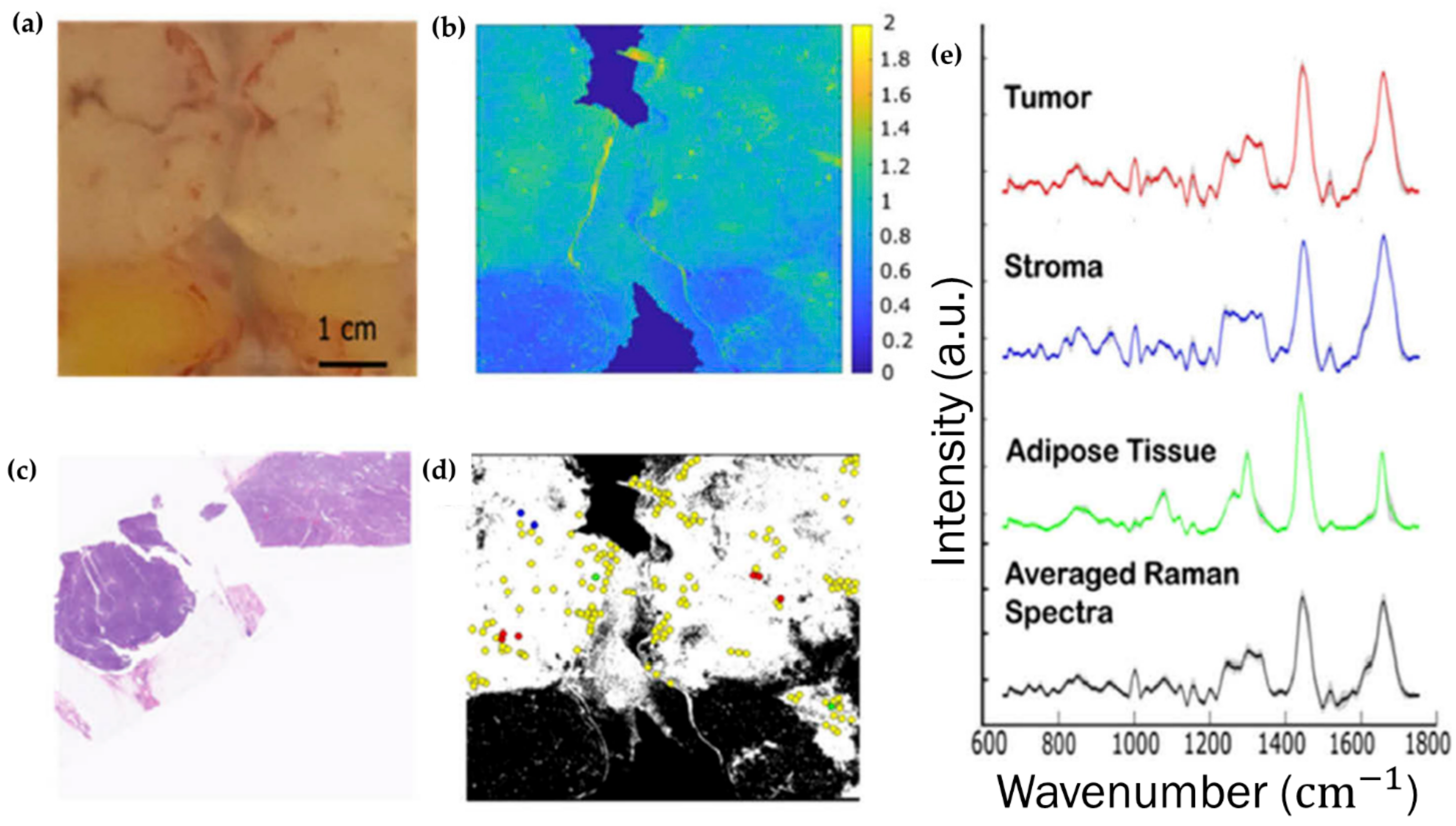 Cancers 13 05336 g005 Cancers 13 05336 g005