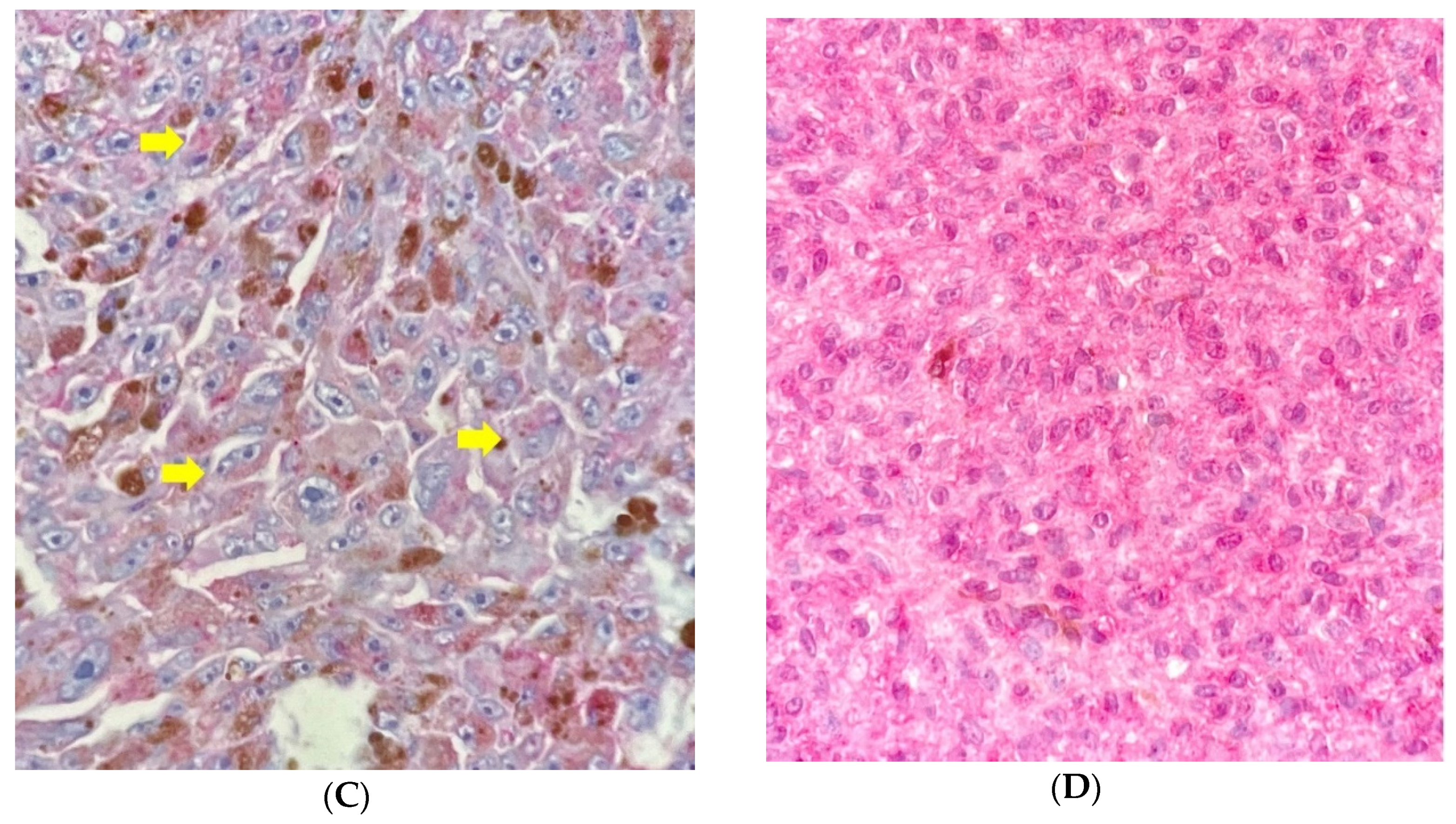Cancers 13 05347 g003b 550