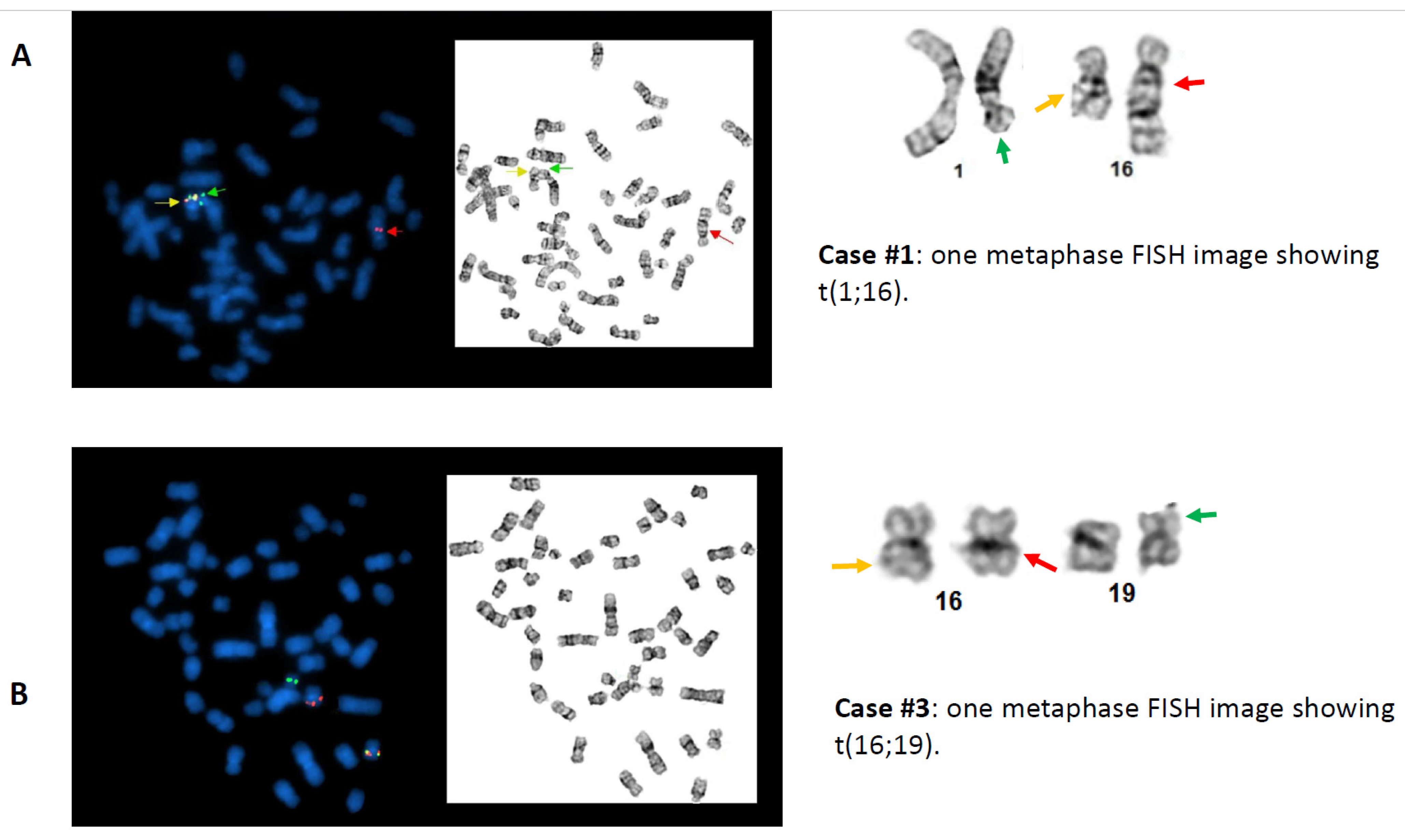 Cancers 13 05354 g002 Cancers 13 05354 g002