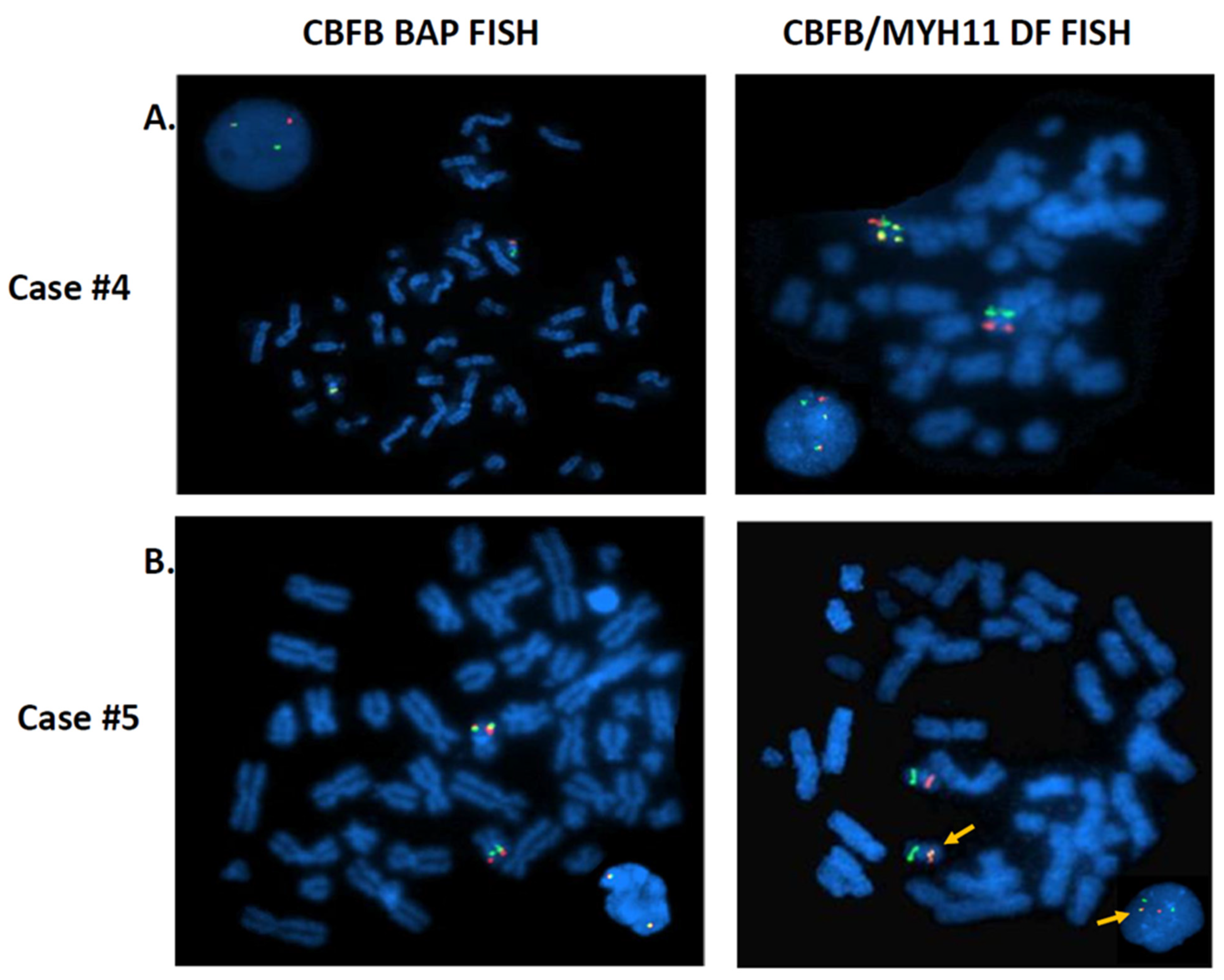 Cancers 13 05354 g003 Cancers 13 05354 g003
