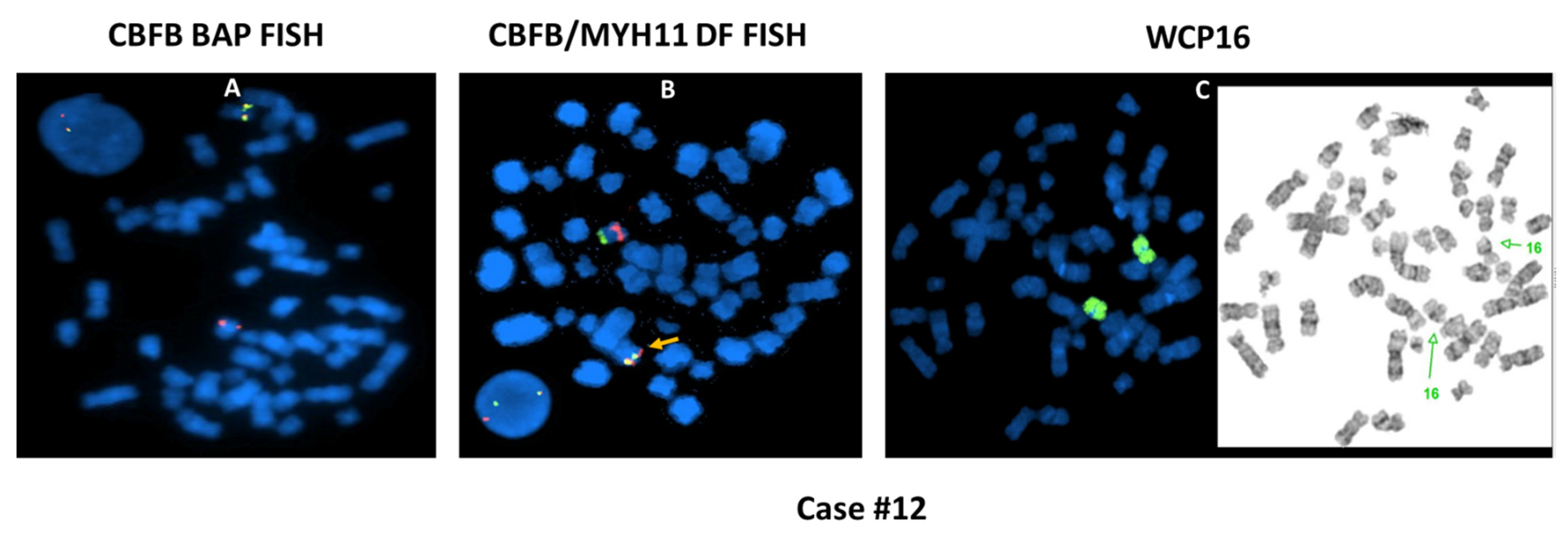 Cancers 13 05354 g004 Cancers 13 05354 g004