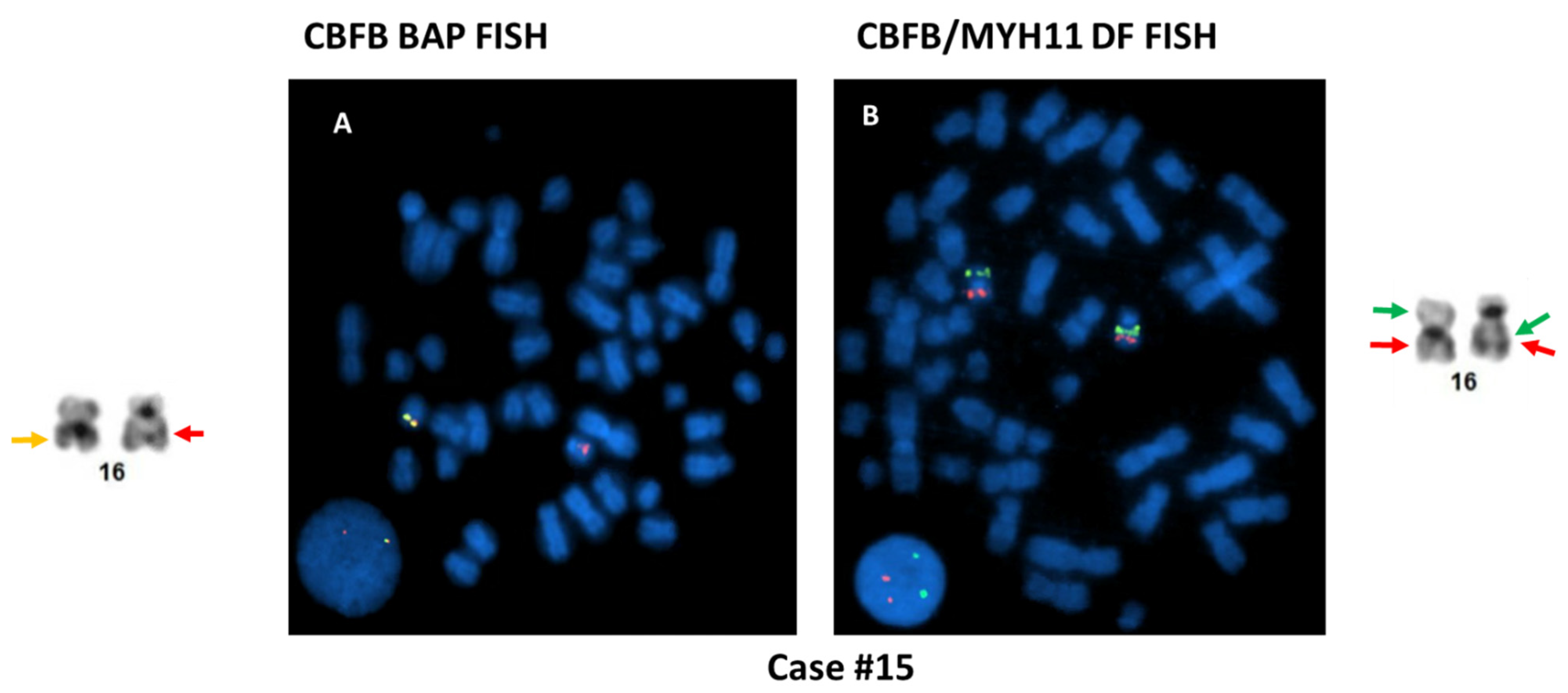 Cancers 13 05354 g005 Cancers 13 05354 g005