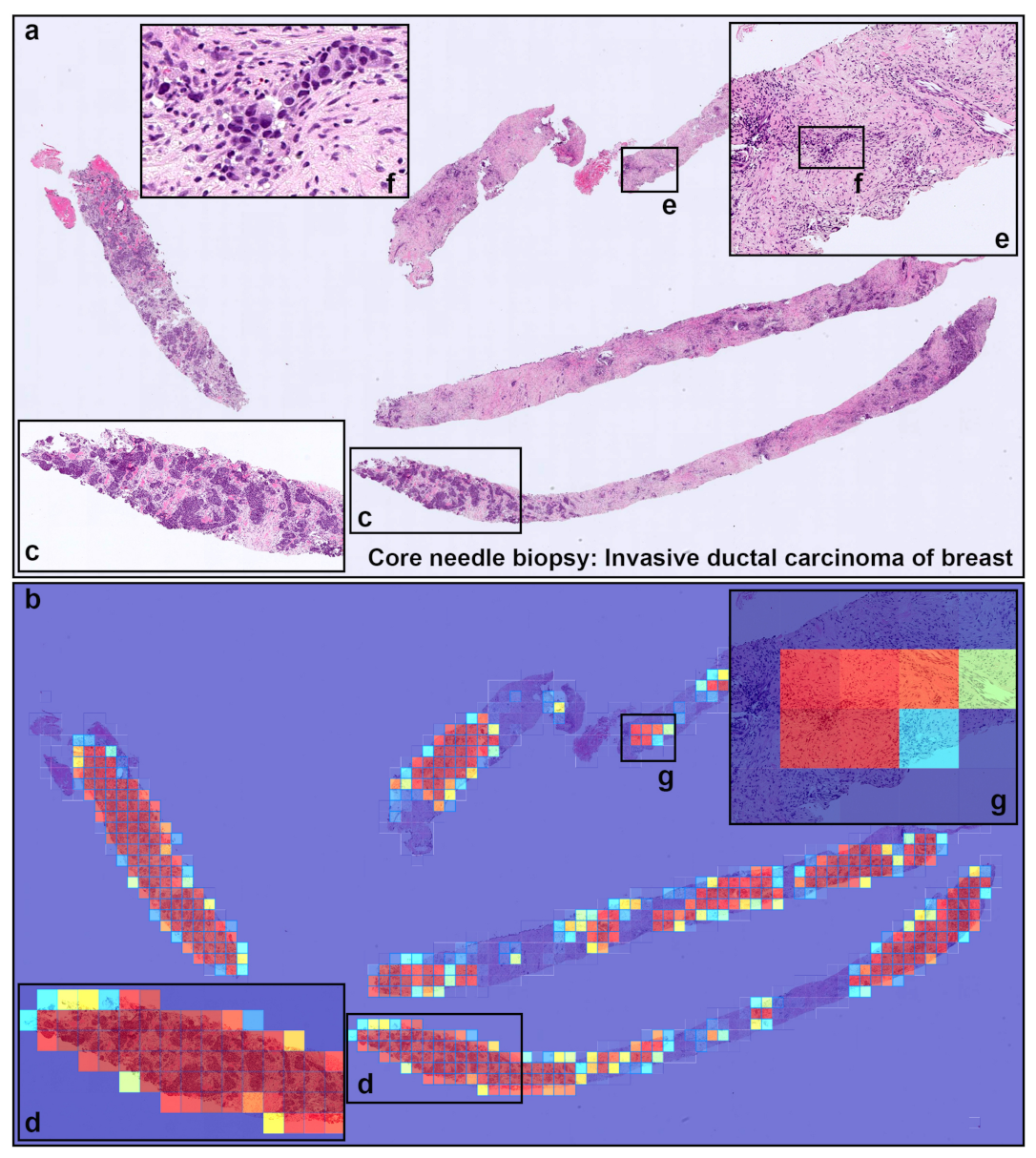 Cancers 13 05368 g004 550