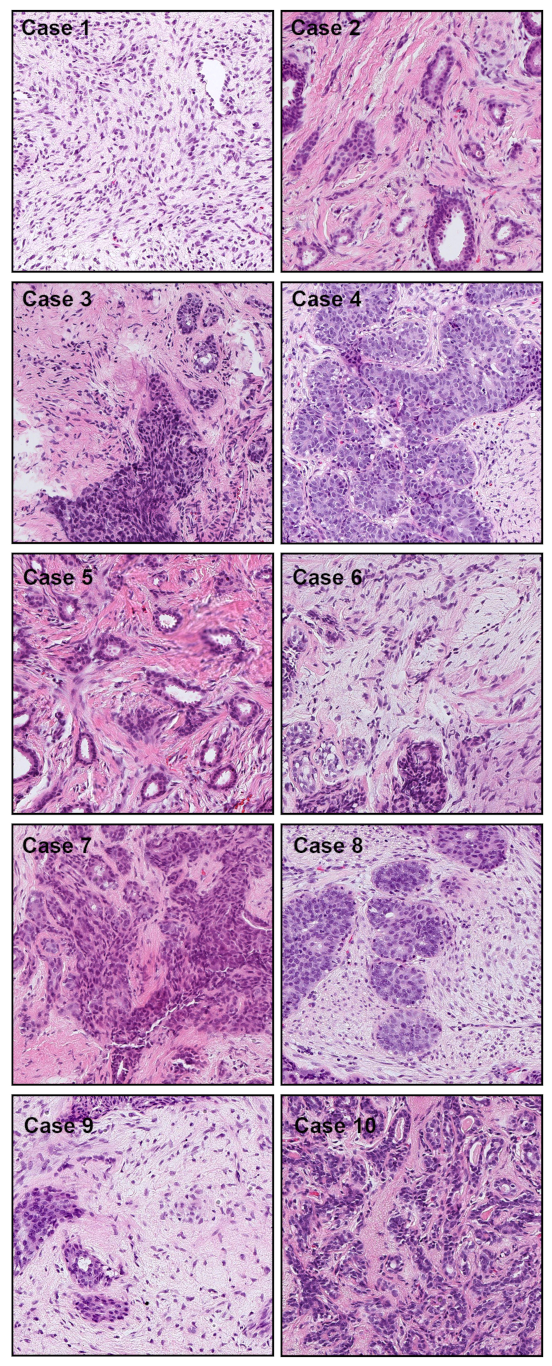 Cancers 13 05368 g008 550