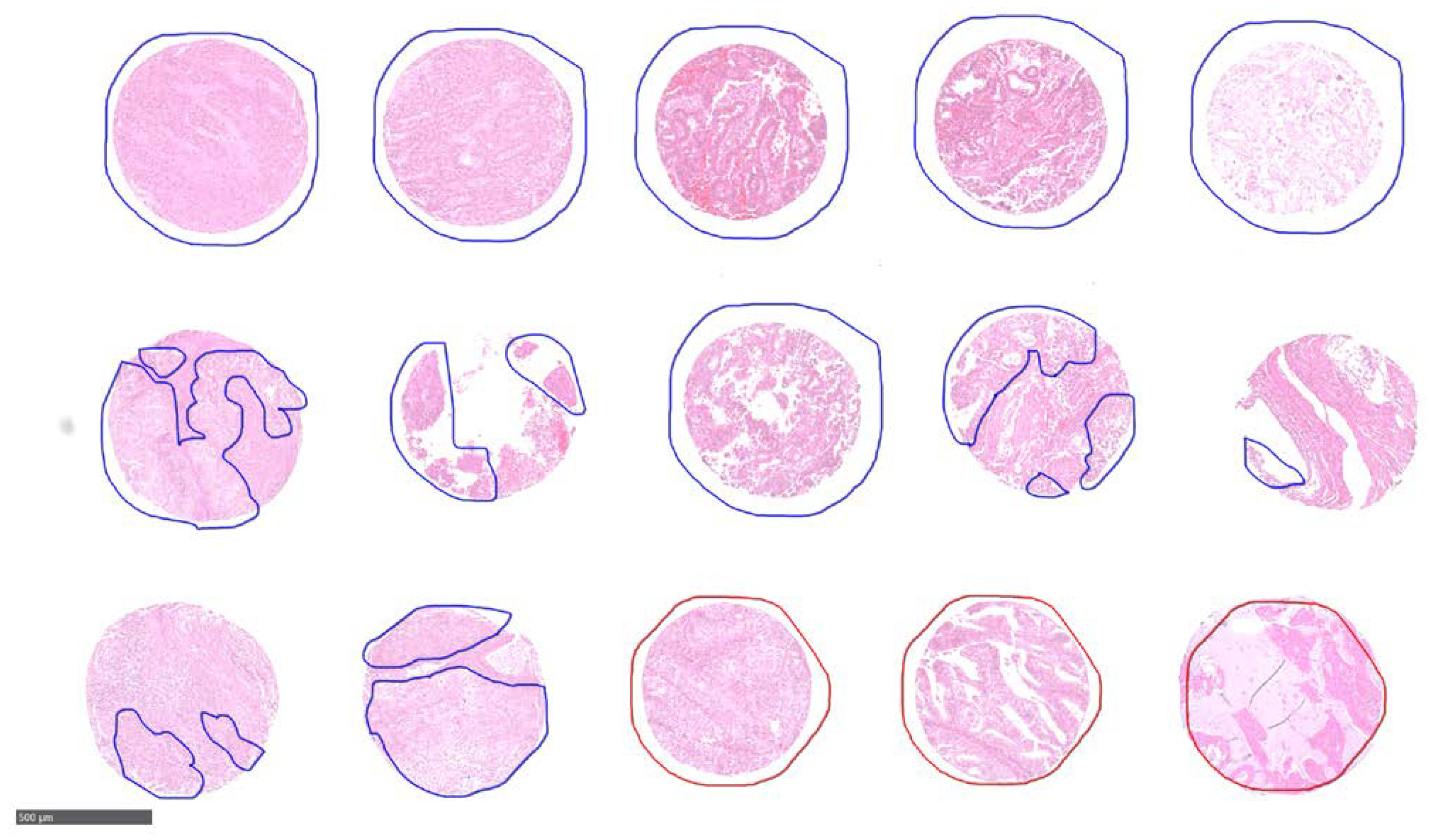 Cancers 13 05388 g002 550