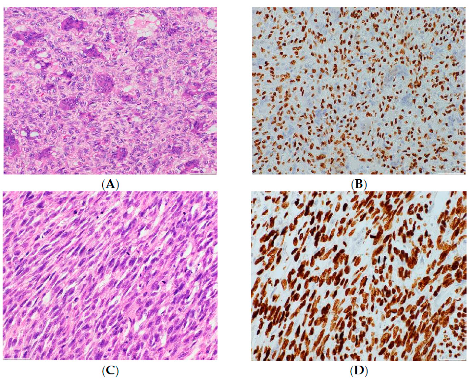 Cancers 13 05410 g002