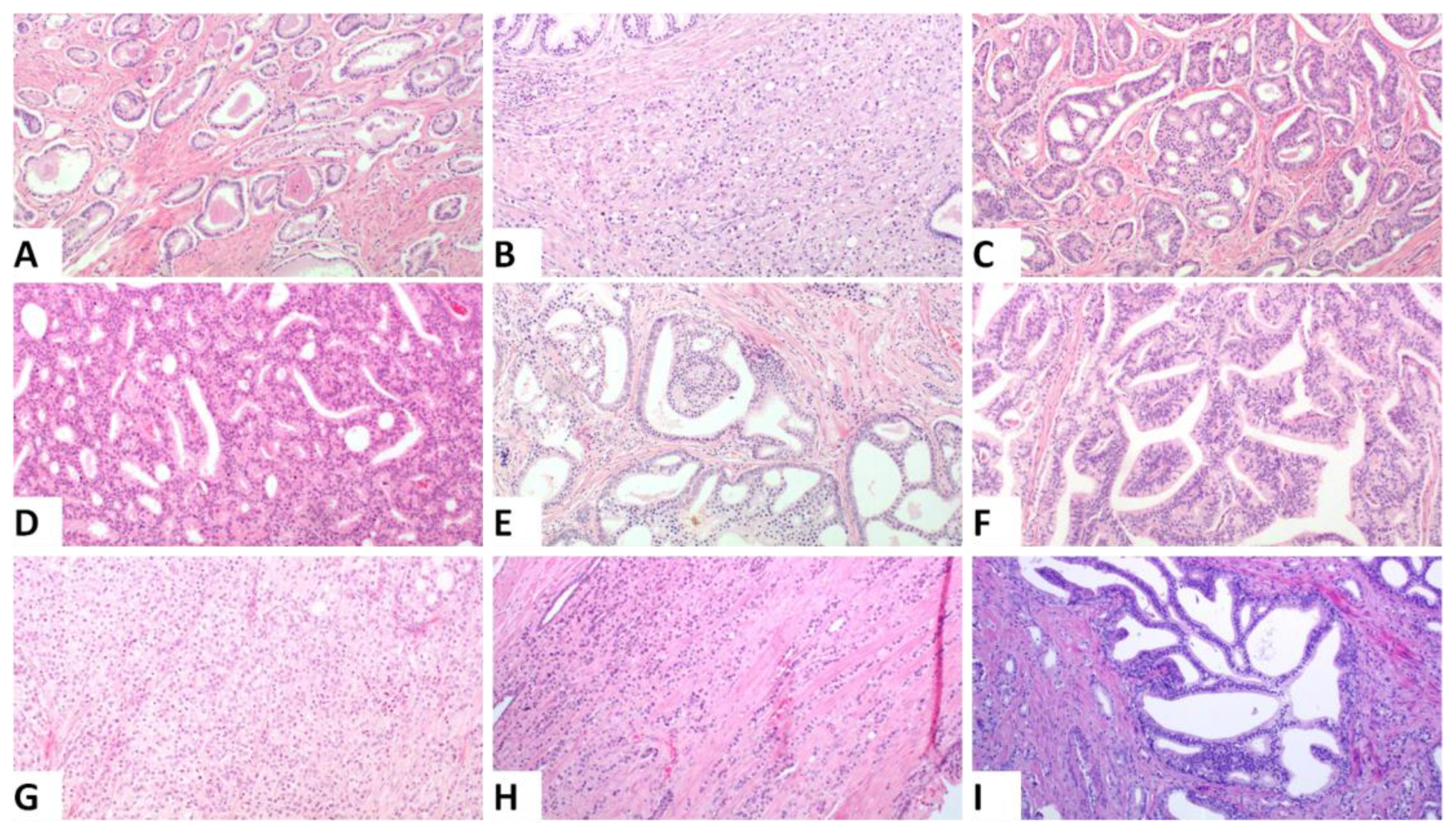 Cancers 13 05454 g001 550