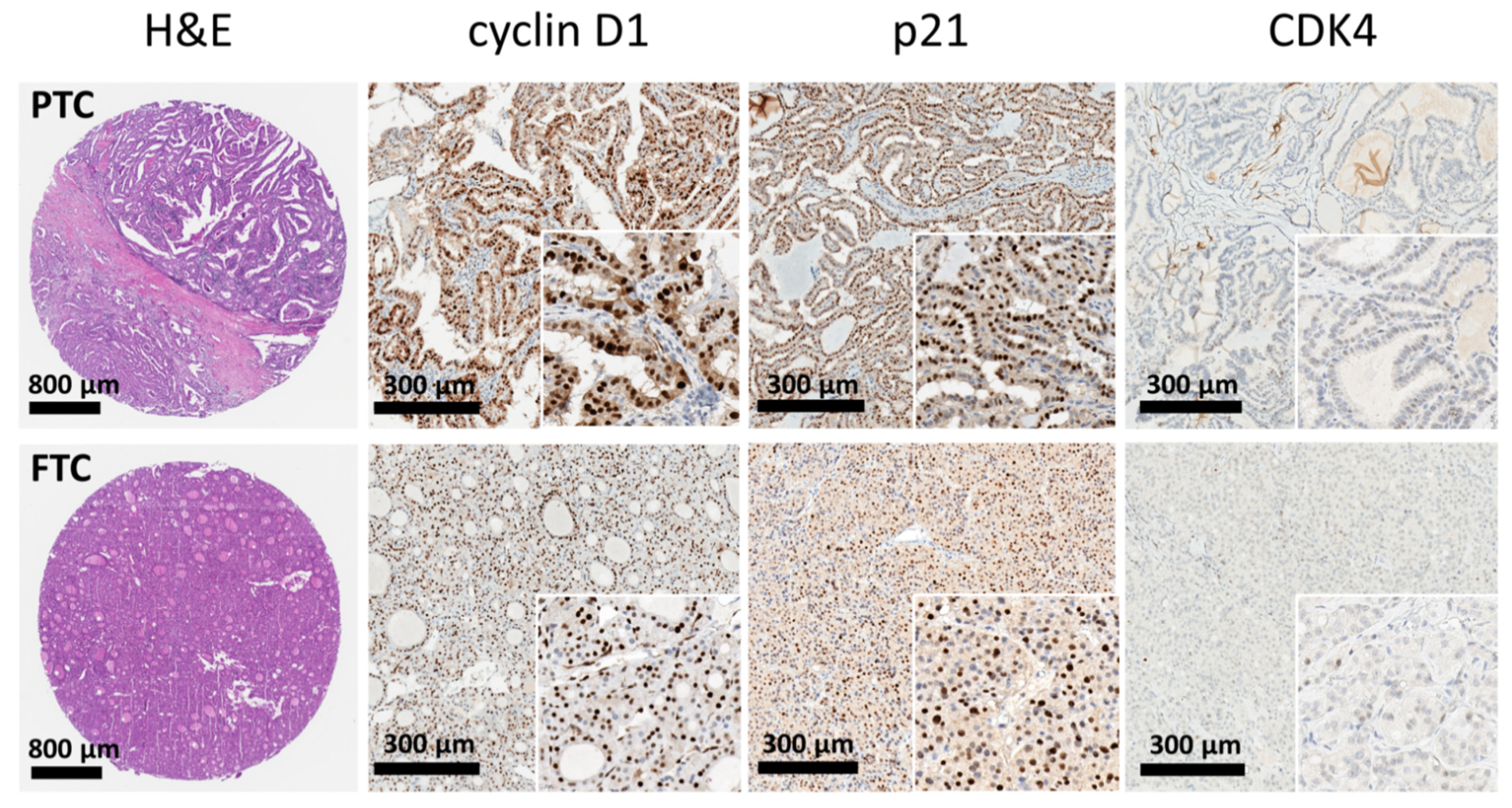 Cancers 13 05486 g001 Cancers 13 05486 g001