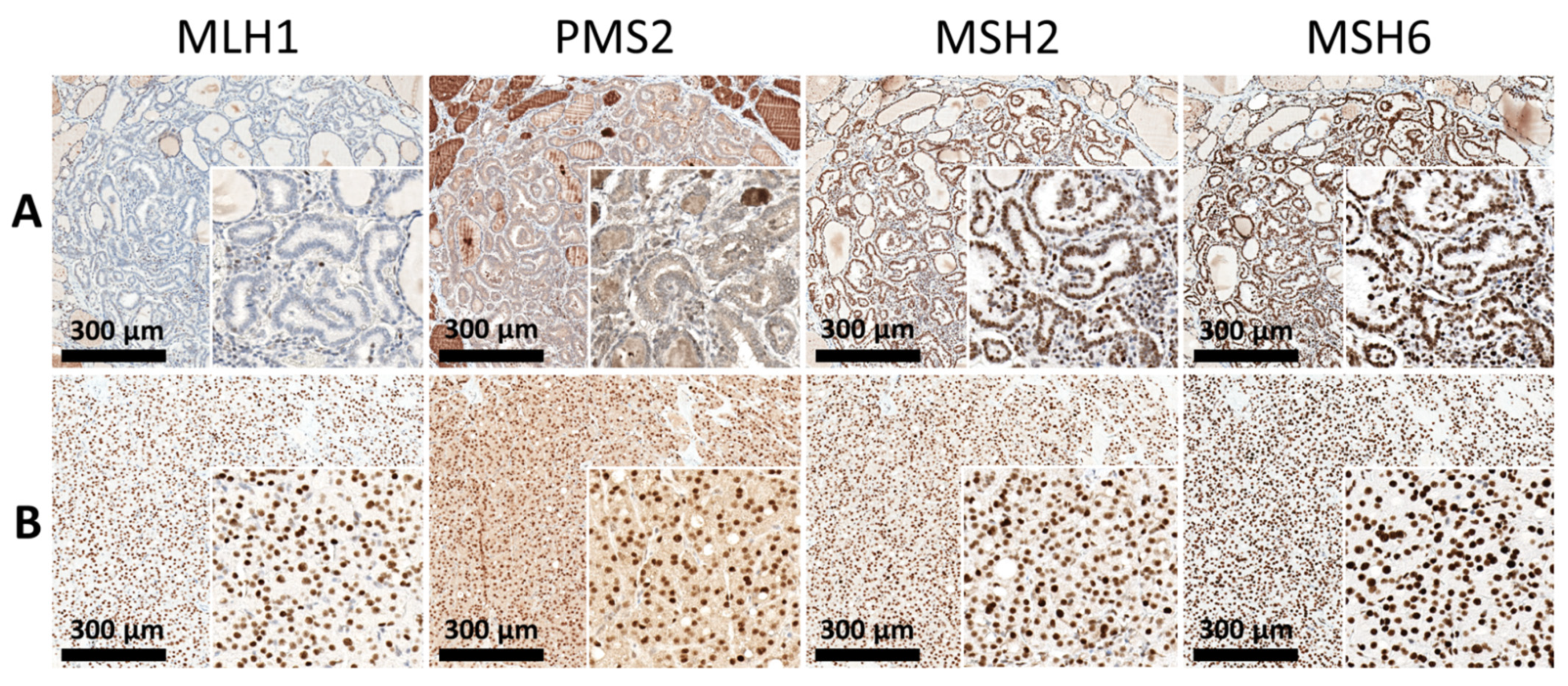 Cancers 13 05486 g002 Cancers 13 05486 g002