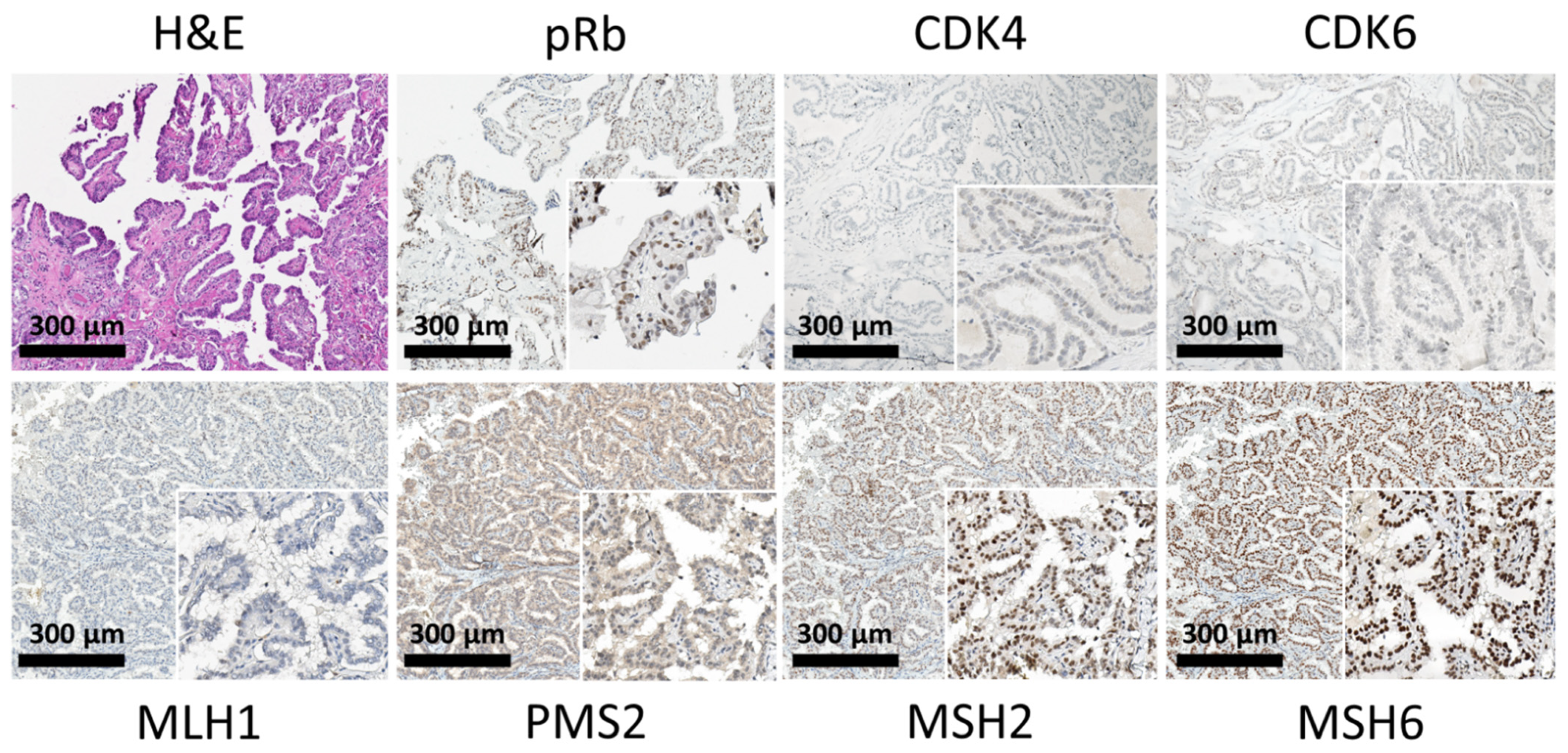 Cancers 13 05486 g003 Cancers 13 05486 g003