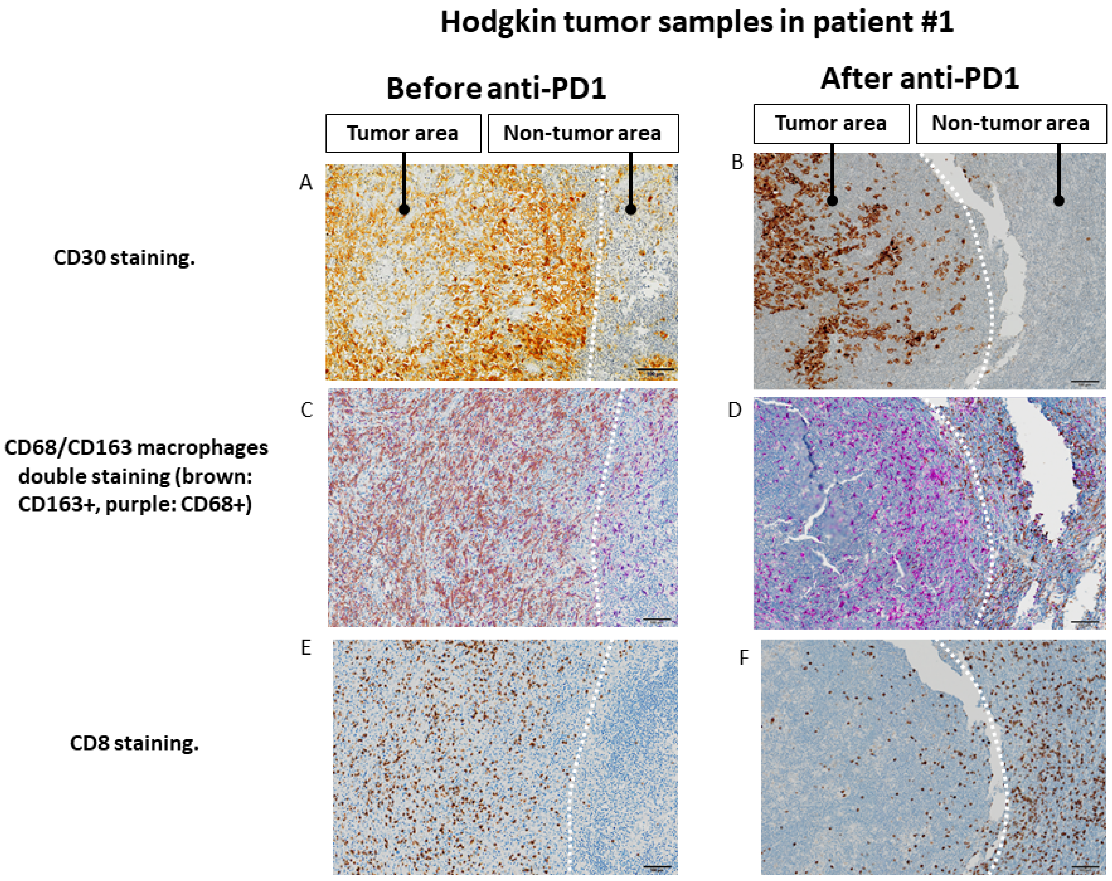 Cancers 13 05487 g004 550