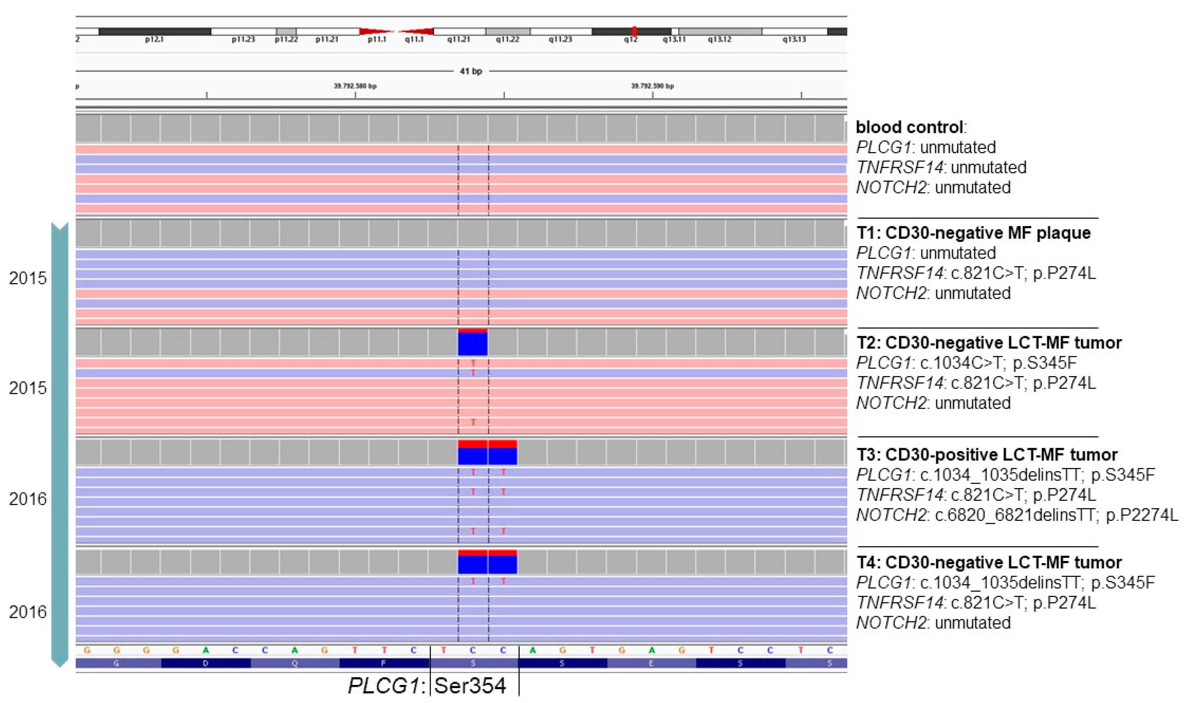 Targeted Deep Sequencing of Mycosis Fungoides Reveals