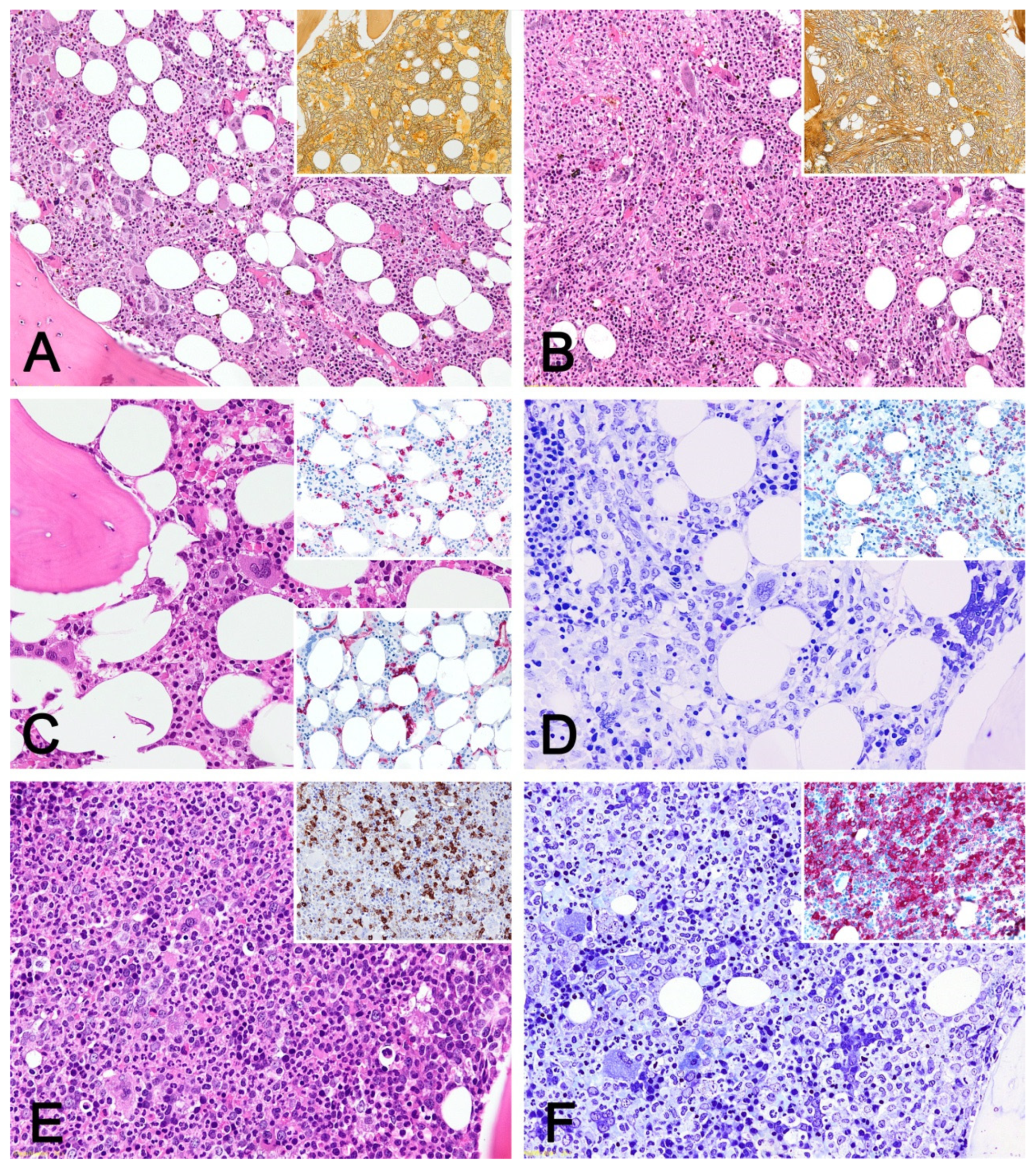 Cancers 13 05531 g001 Cancers 13 05531 g001