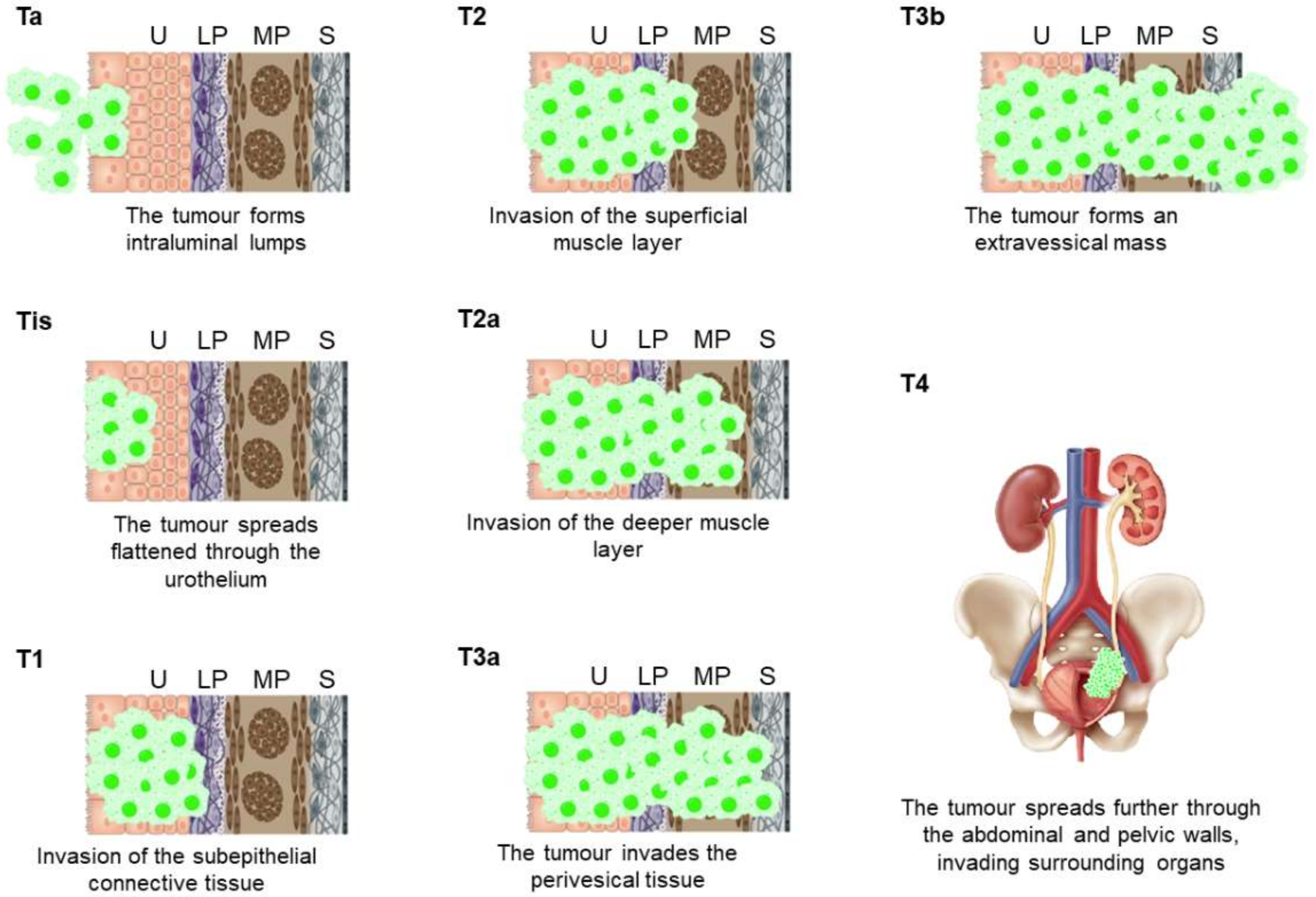 Cancers 13 05537 g001 Cancers 13 05537 g001