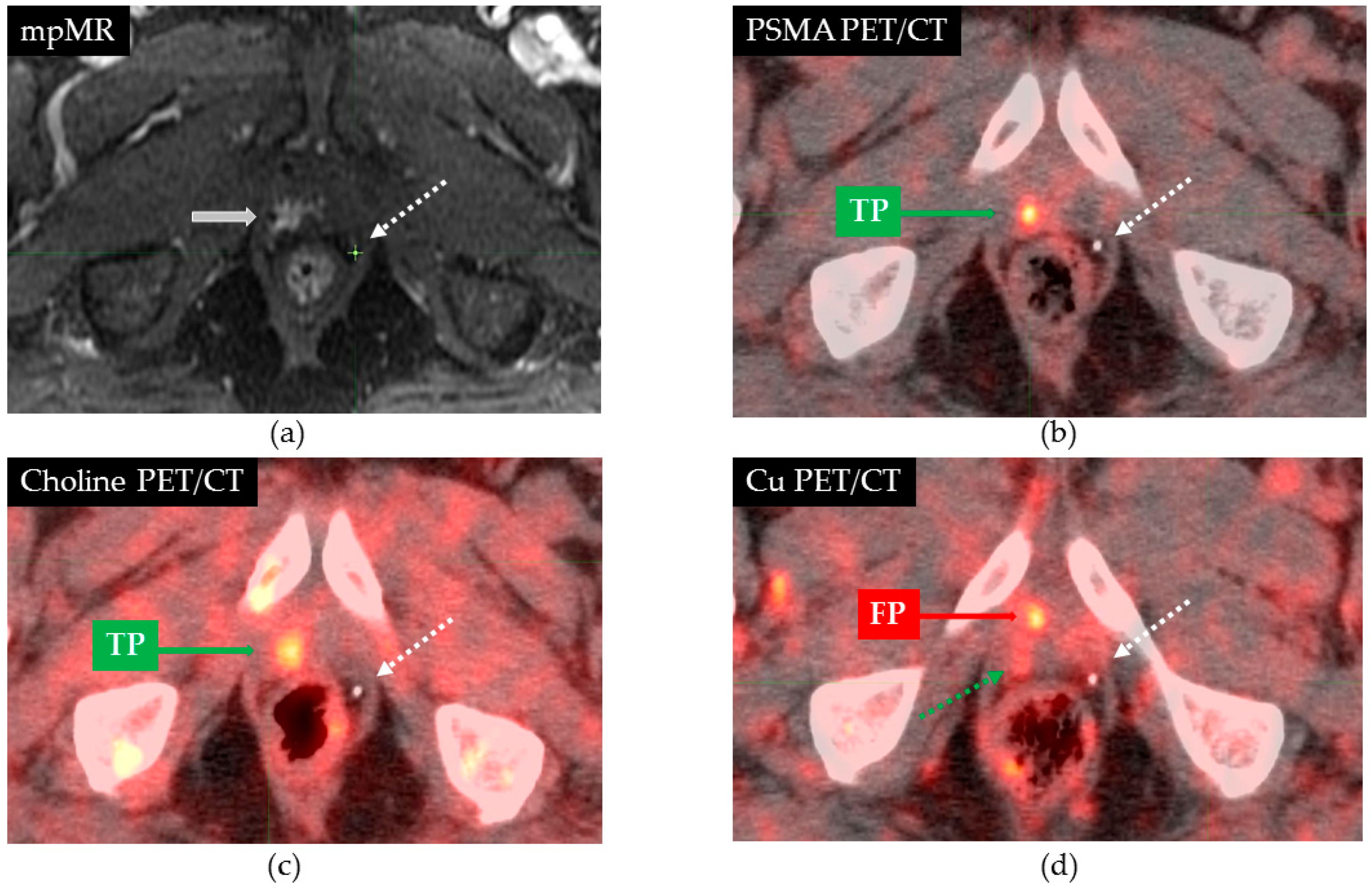 Cancers 13 05564 g001 550
