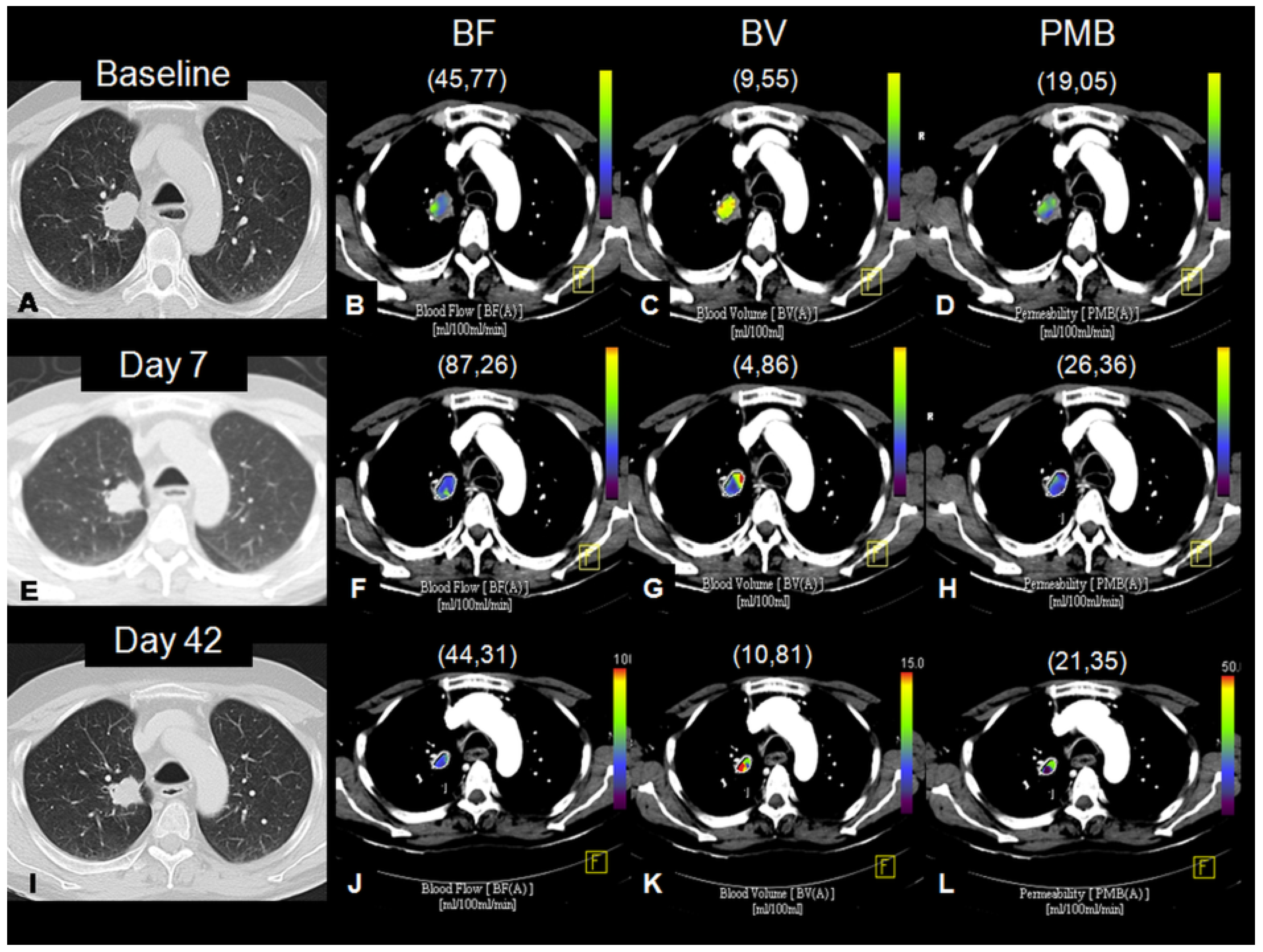 Cancers 13 05566 g006