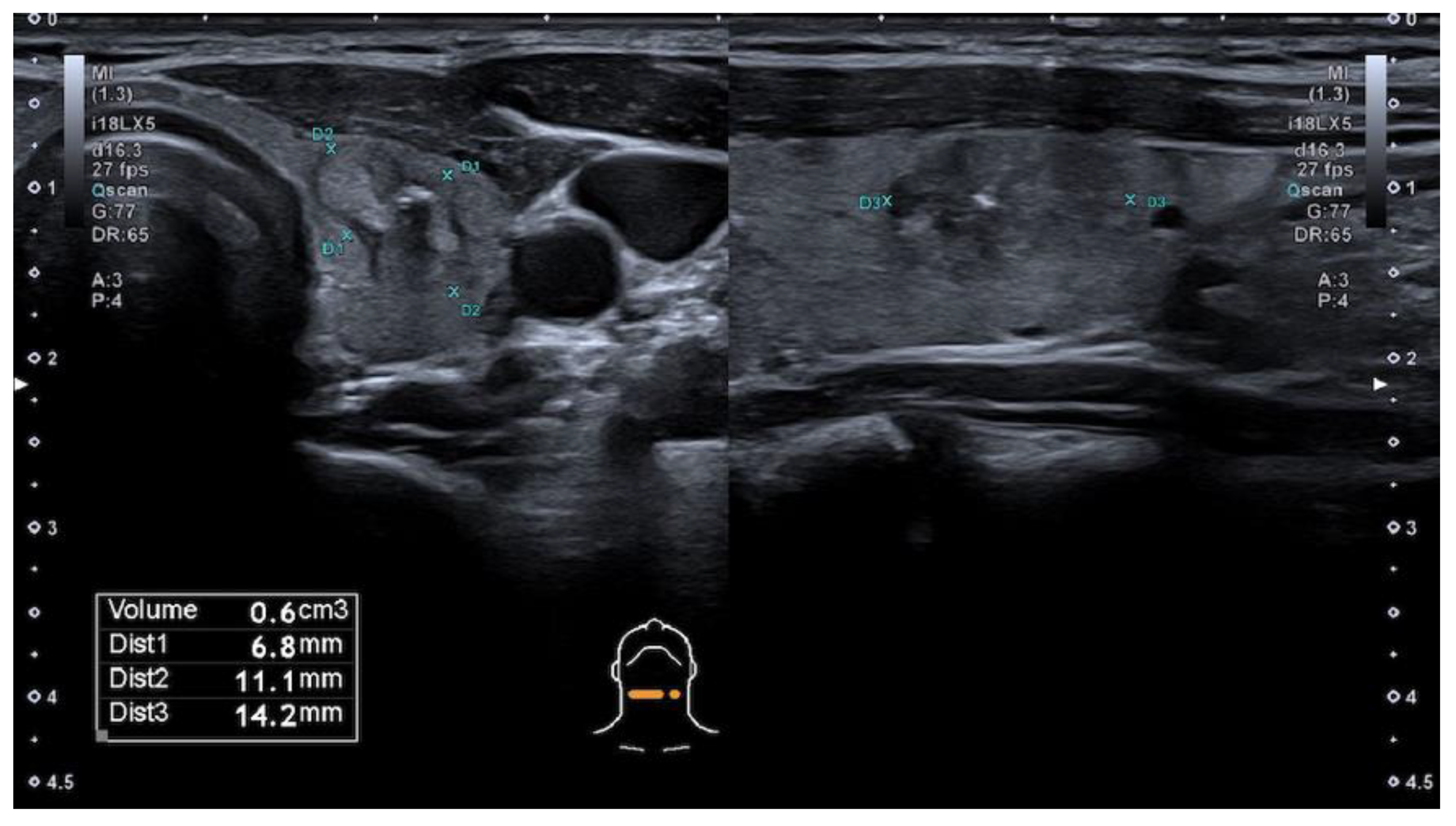 Cancers 13 05581 g002