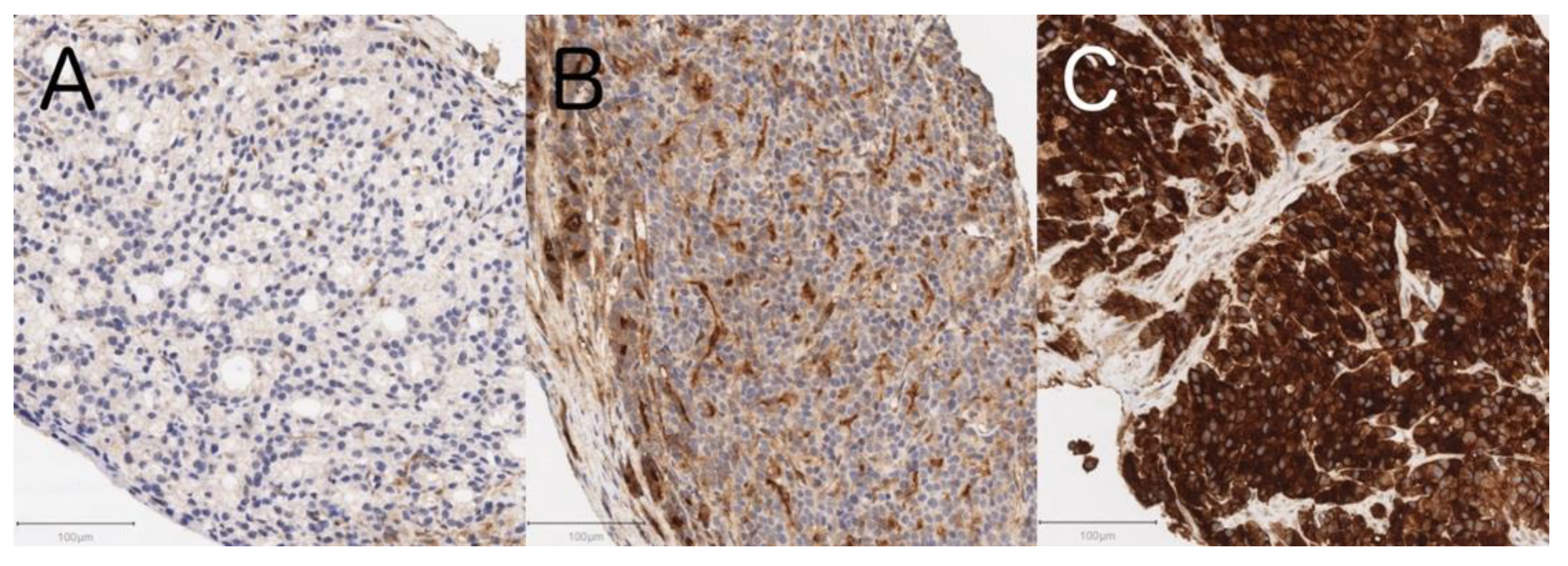 Cancers 13 05587 g002 Cancers 13 05587 g002