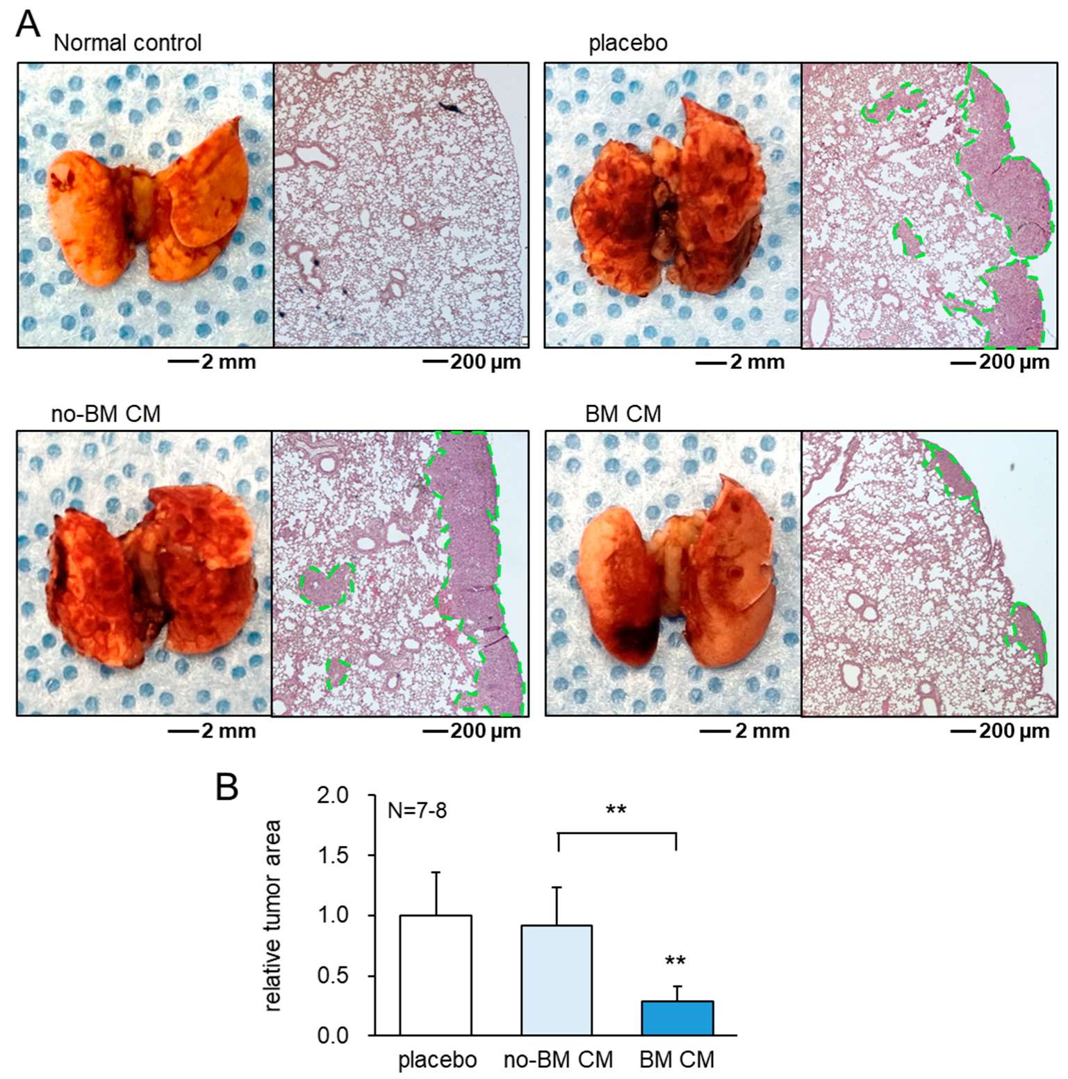 Cancers 13 05593 g005