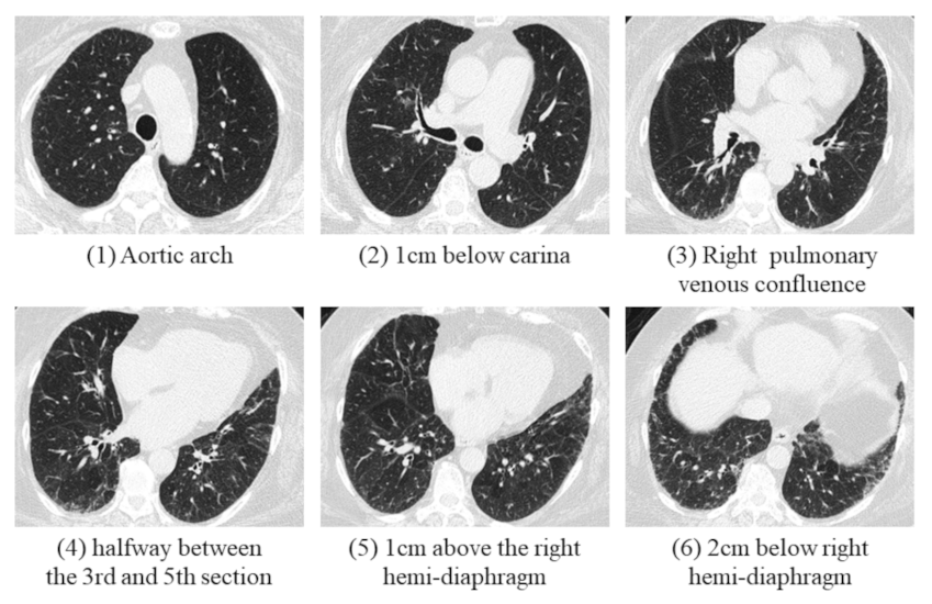 Cancers 13 05600 g001