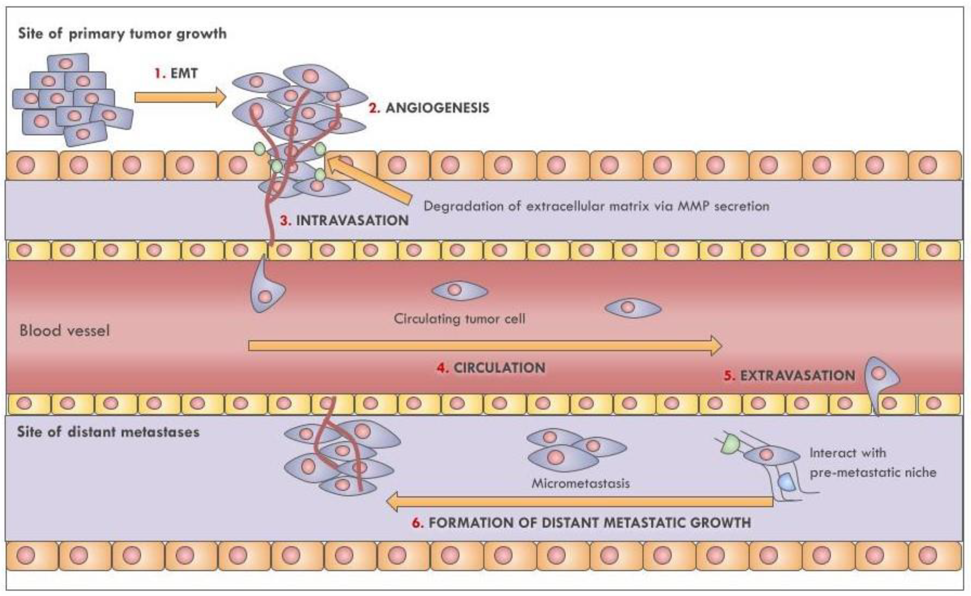 Cancers | Free Full-Text | Extracellular Vesicles in Lung Cancer 