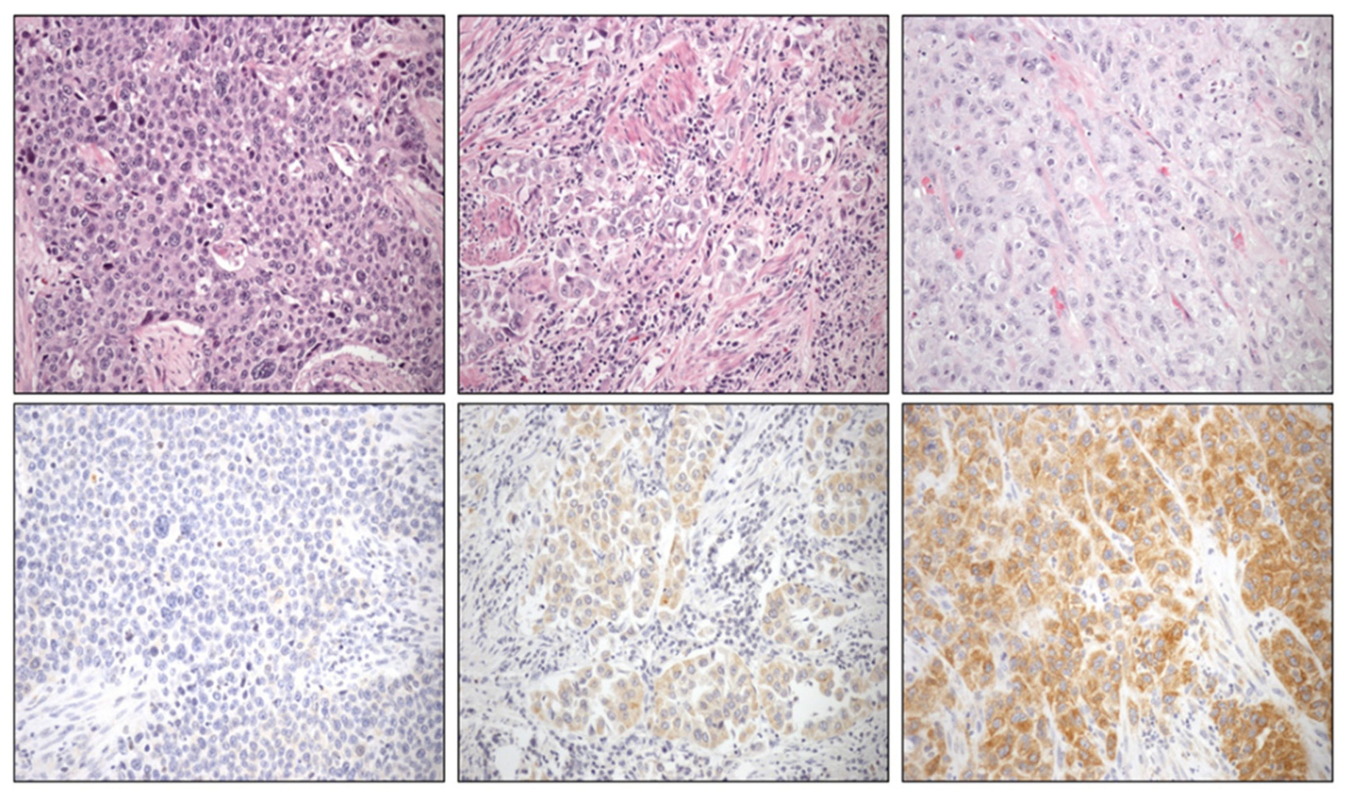 Cancers 13 05642 g001