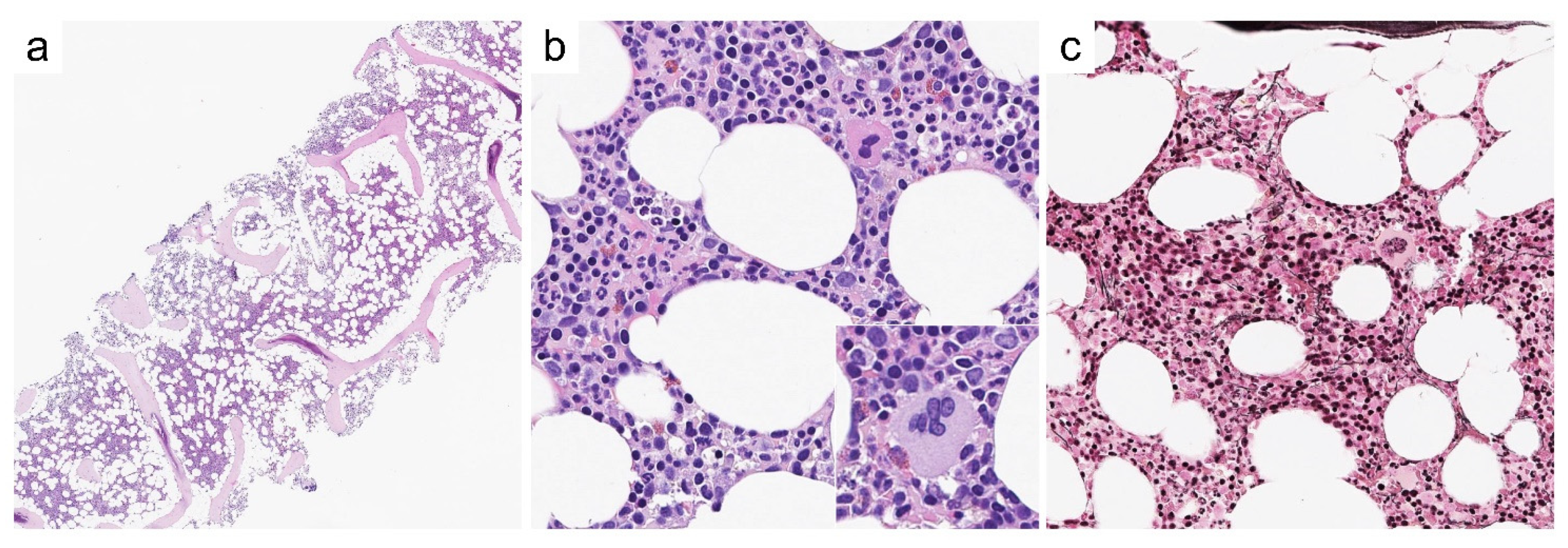 Cancers 13 05666 g002 550