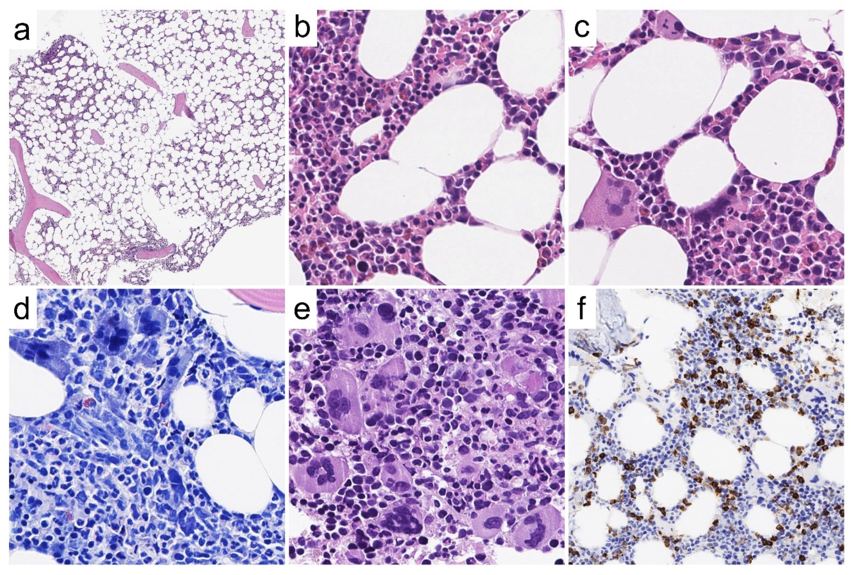 Cancers 13 05666 g004 550