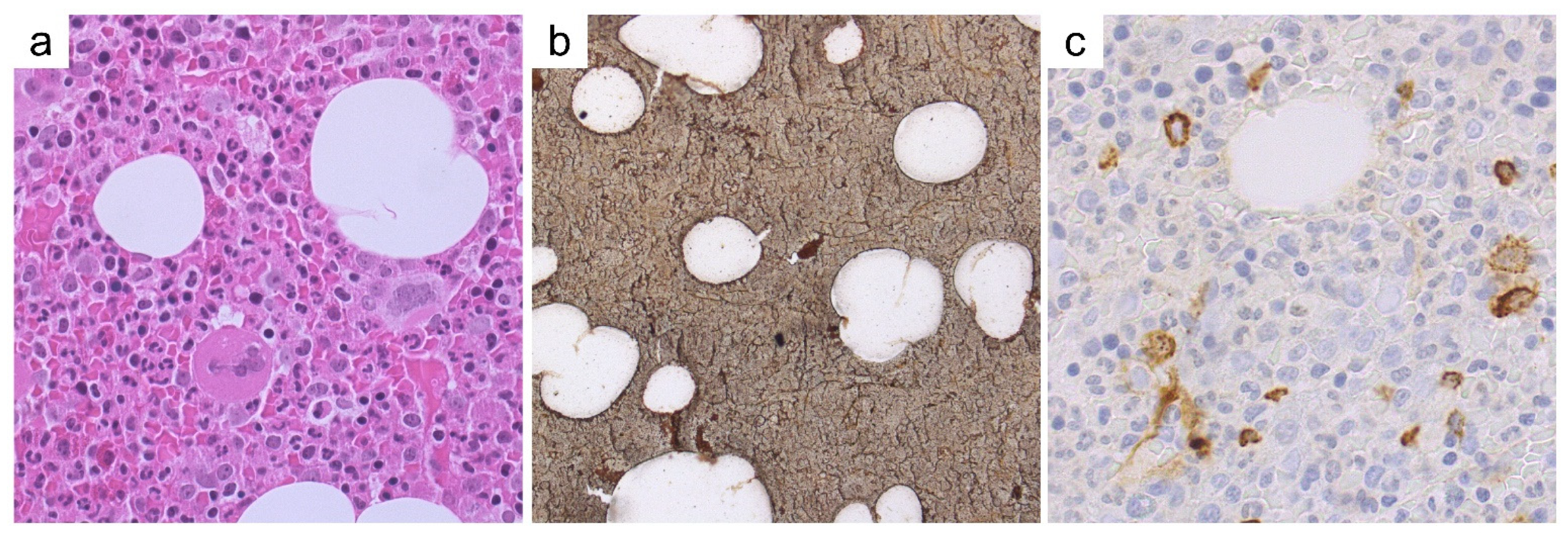 Cancers 13 05666 g005 550