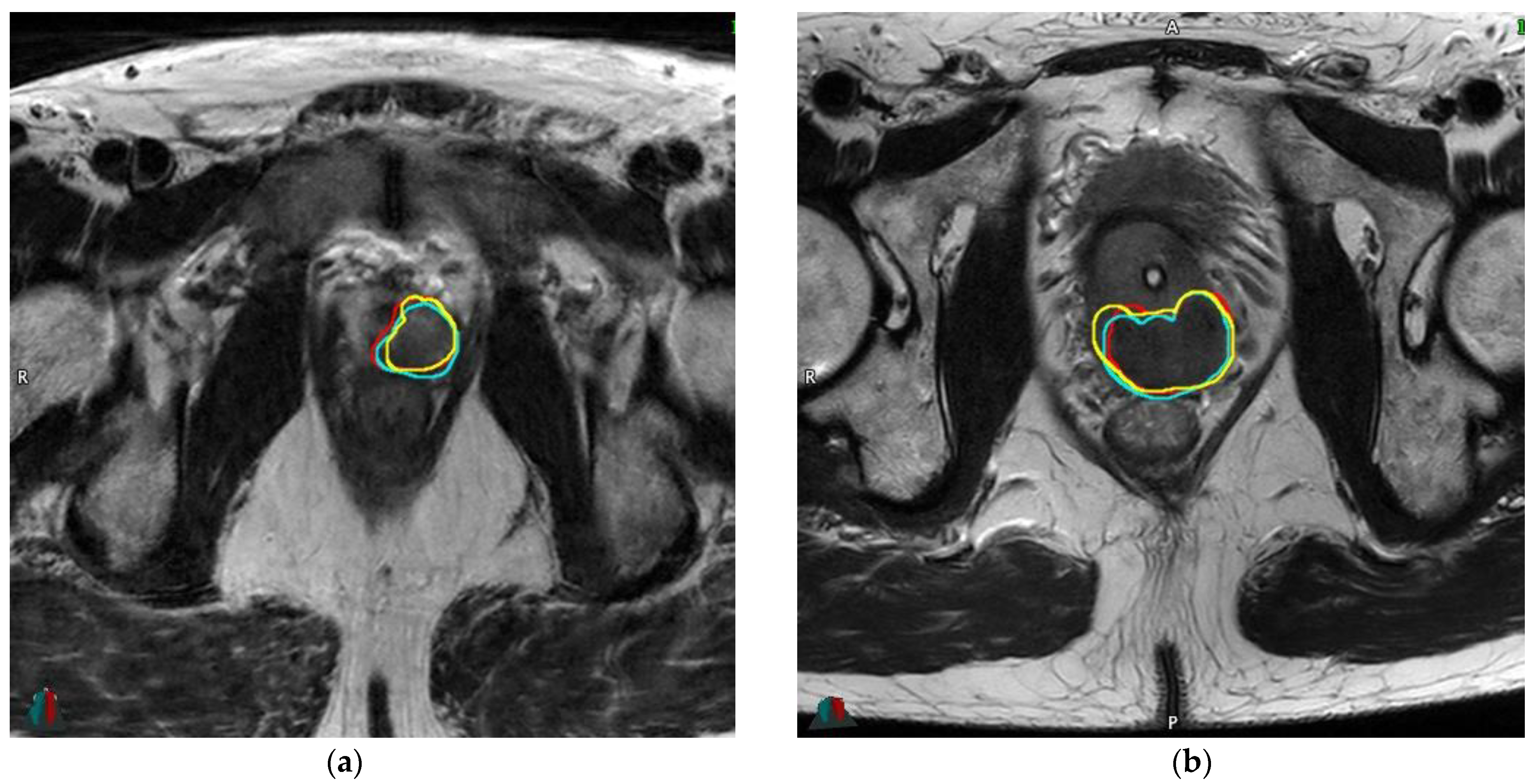 Cancers 13 05672 g002