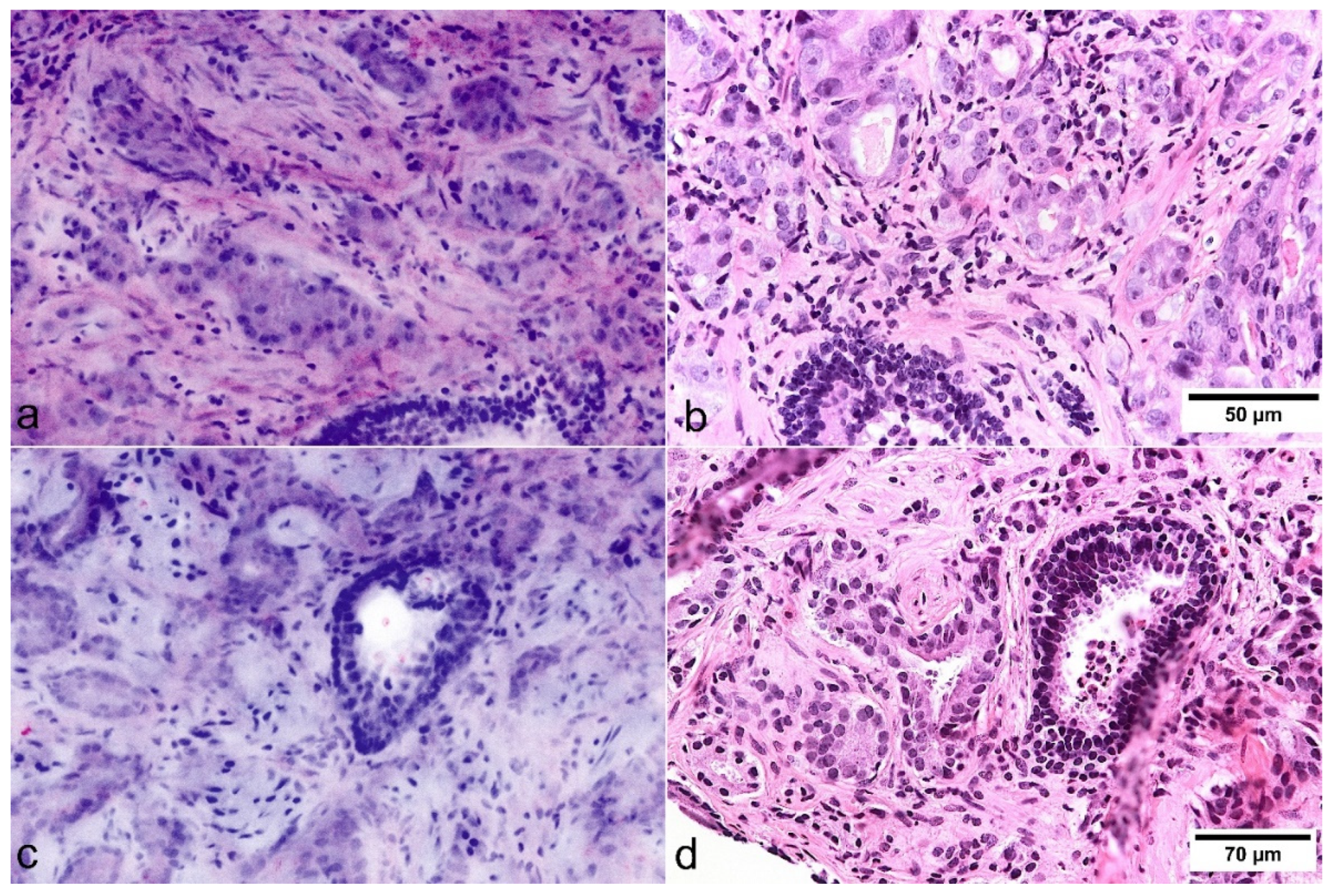 Cancers 13 05685 g003 Cancers 13 05685 g003