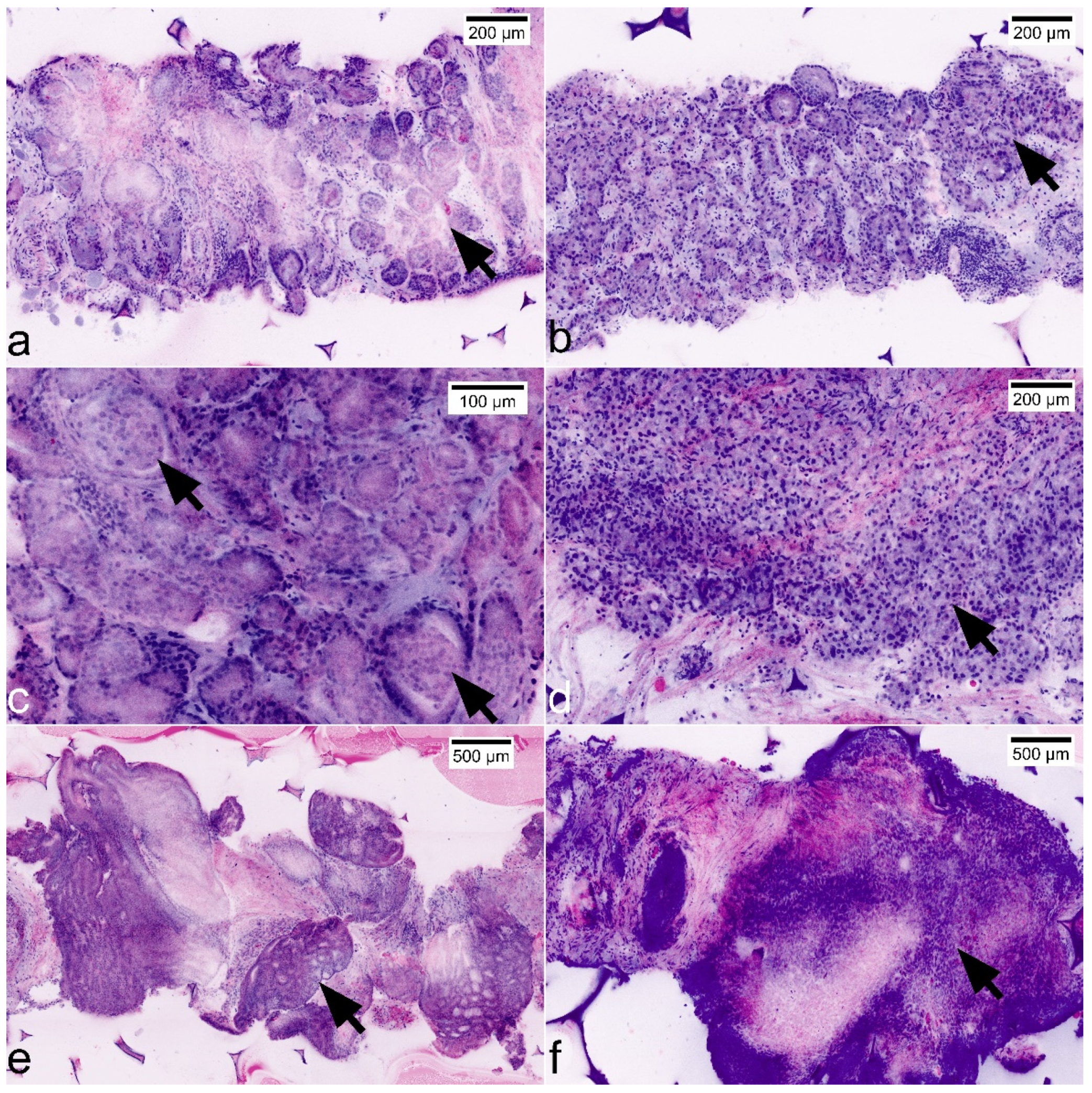 Cancers 13 05685 g005 Cancers 13 05685 g005