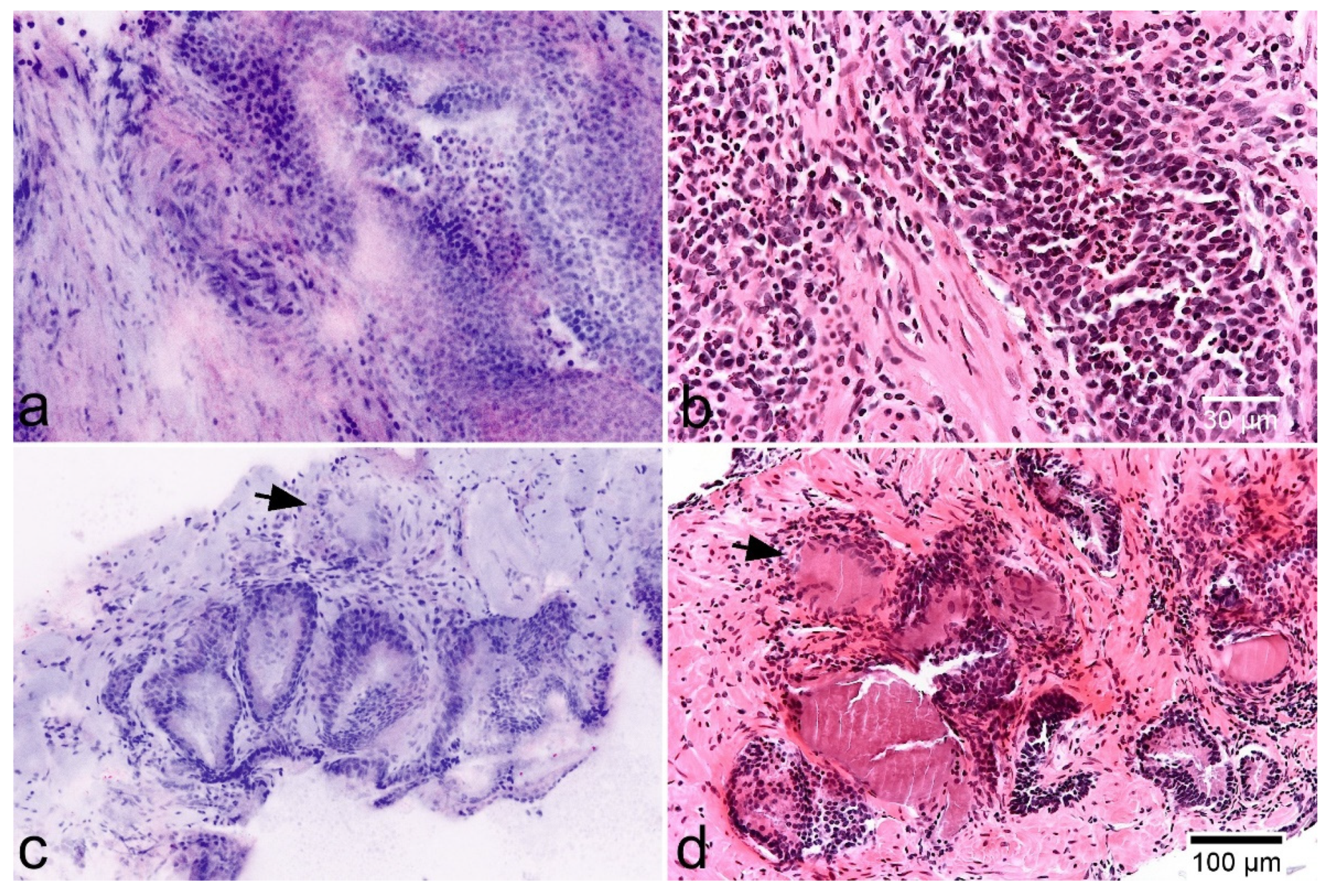 Cancers 13 05685 g006 Cancers 13 05685 g006