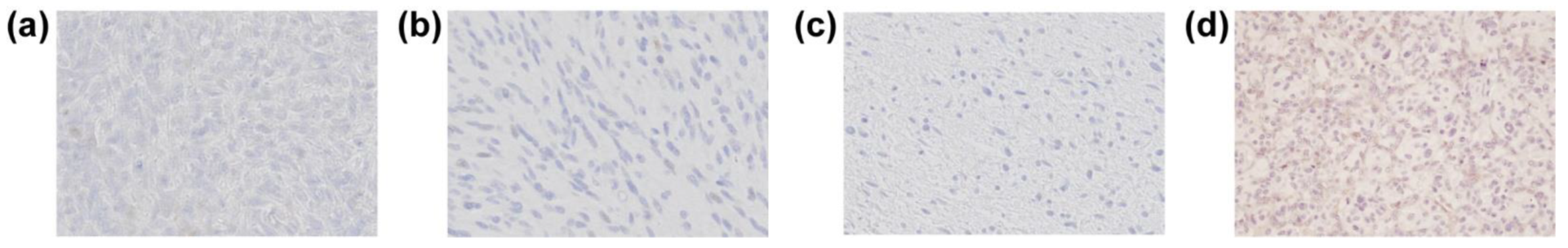 Cancers 13 05704 g004 Cancers 13 05704 g004