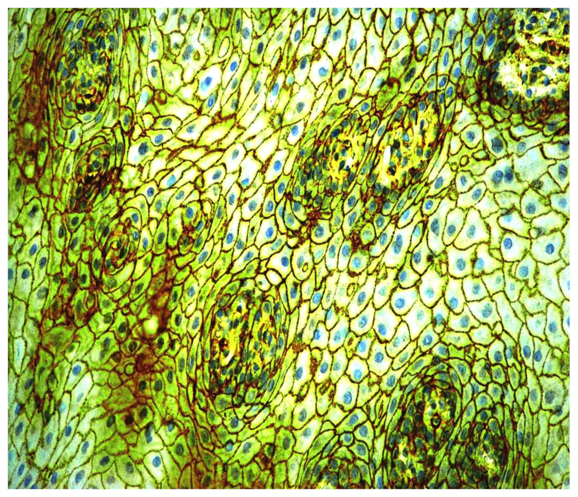 Cancers 13 05739 g009 550