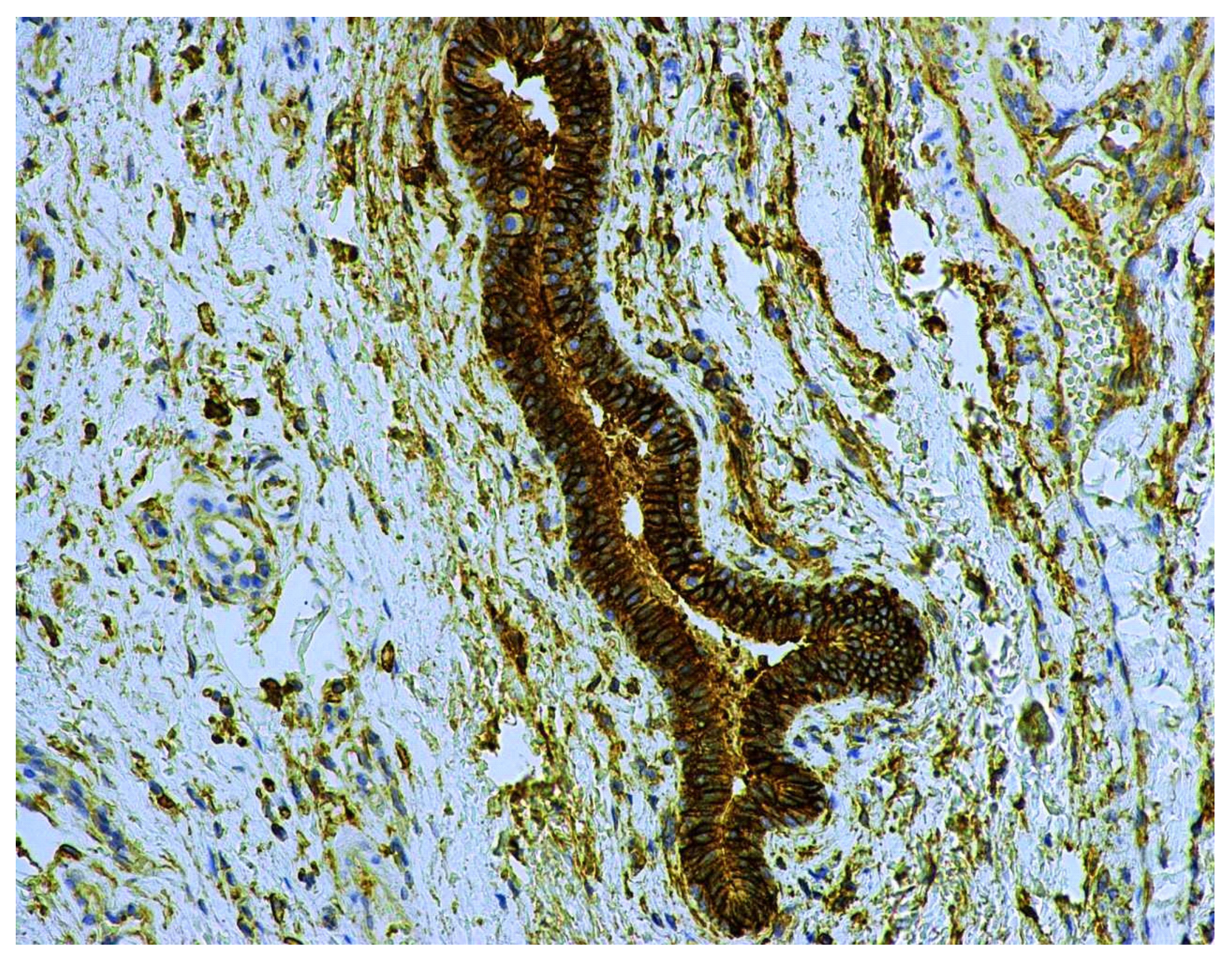 Cancers 13 05739 g010 550