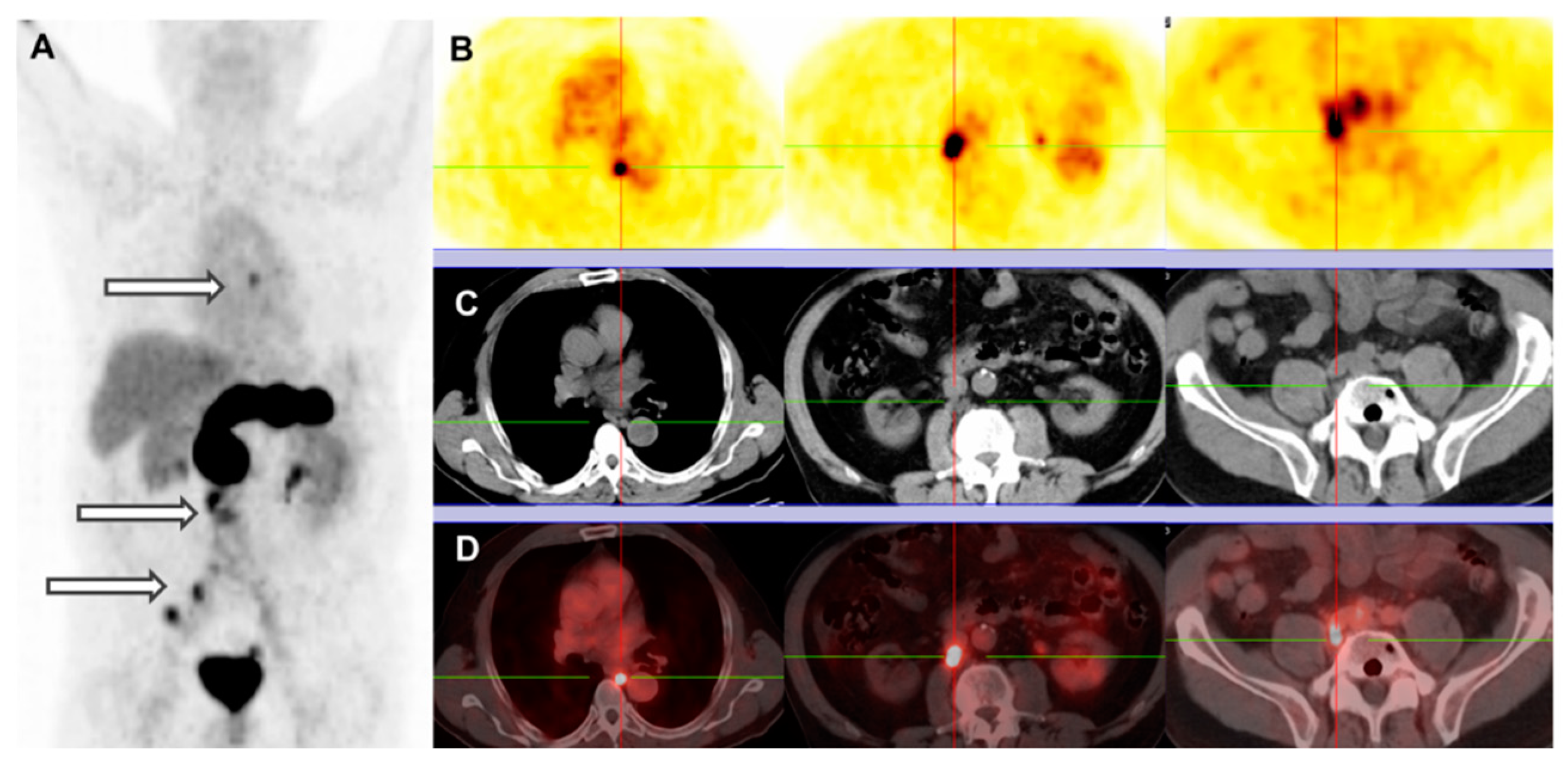 Cancers 13 05766 g004 550