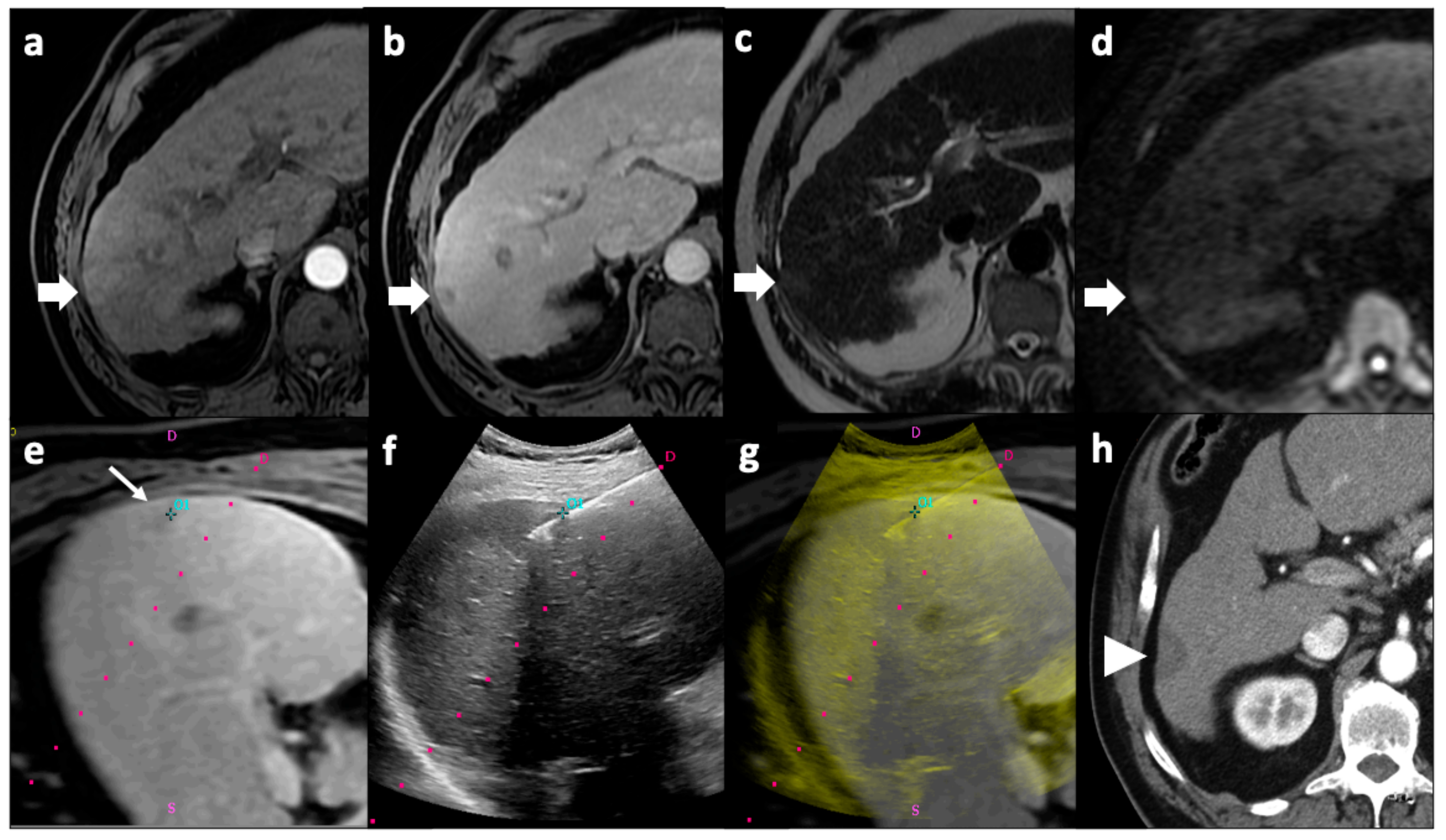 Cancers 13 05797 g002 Cancers 13 05797 g002