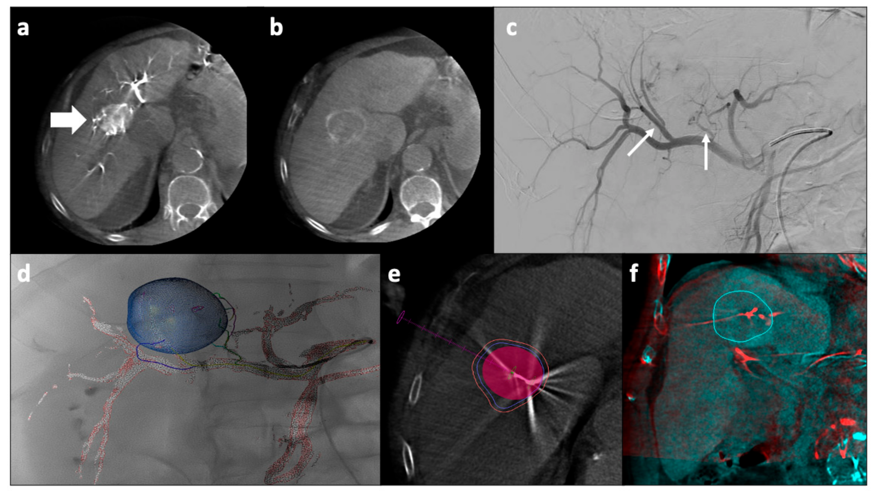 Cancers 13 05797 g003 Cancers 13 05797 g003