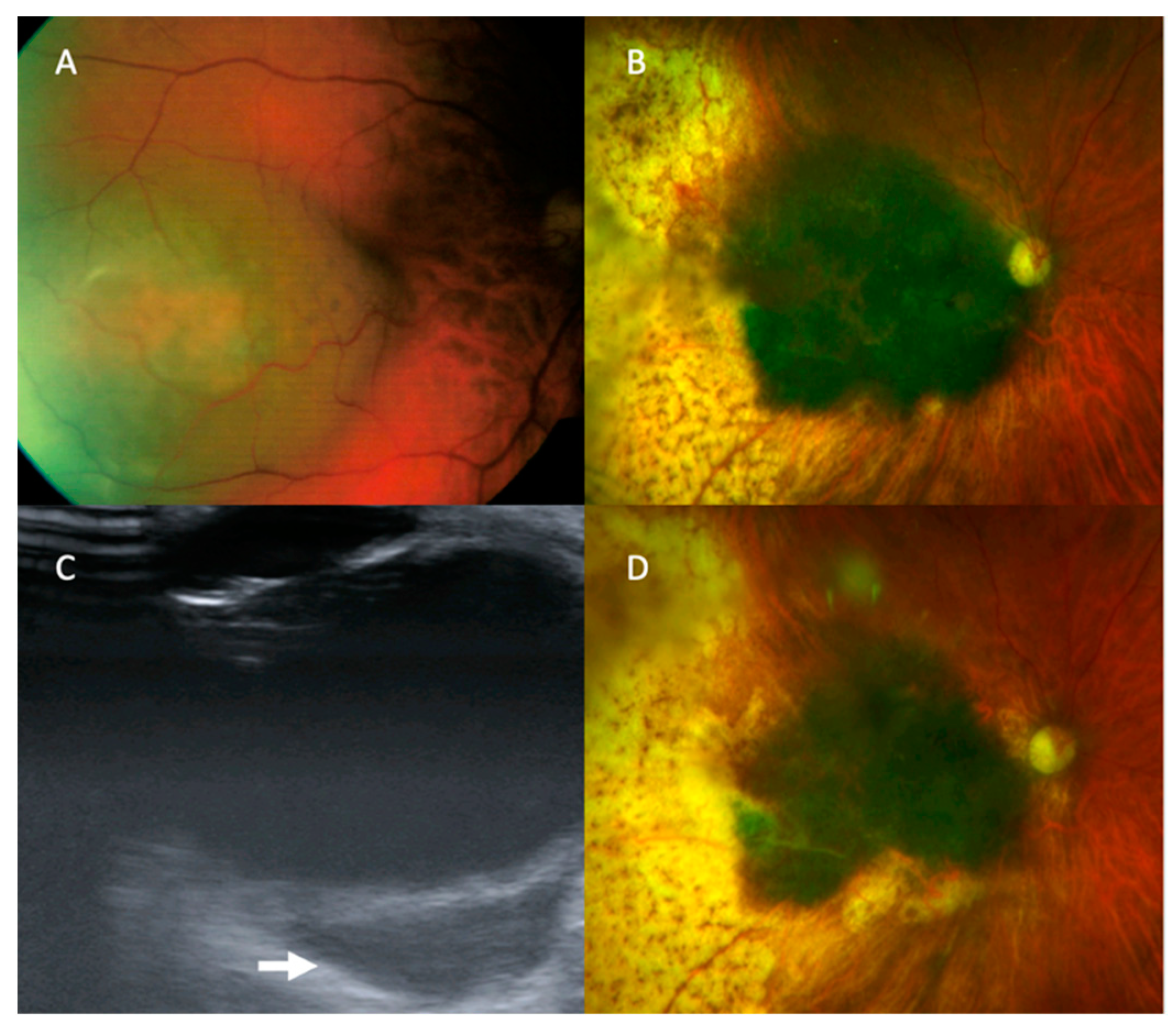 Cancers 13 05832 g002 550