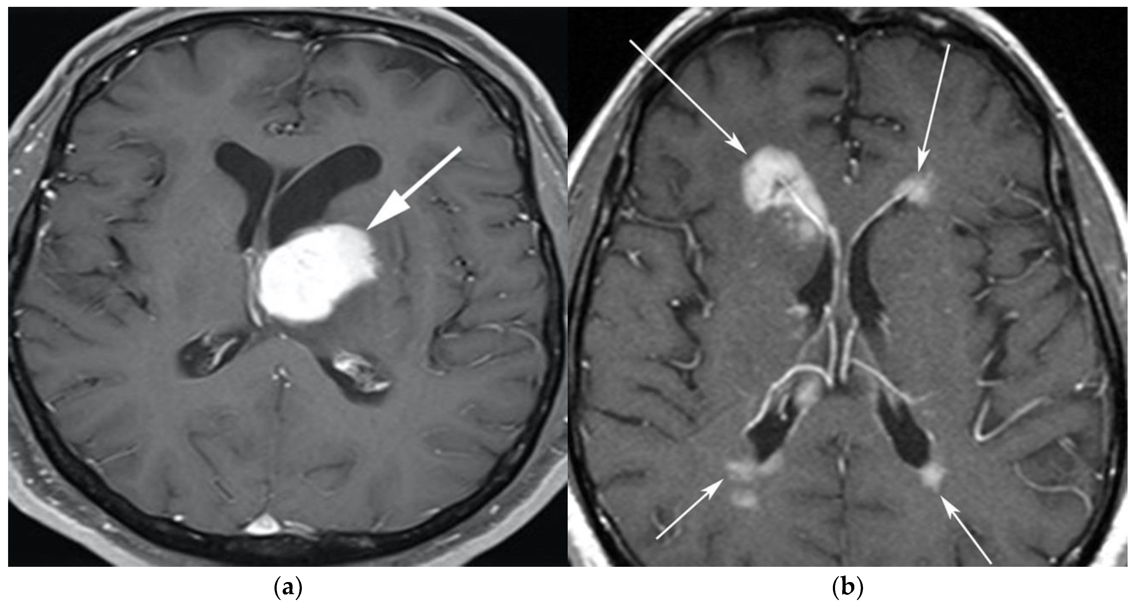 Cancers 13 05853 g001 Cancers 13 05853 g001